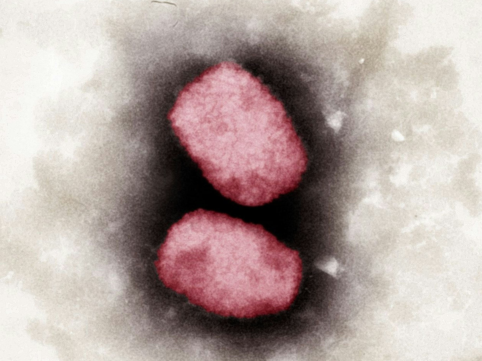 Elektronenmikroskopische Aufnahme von Affenpocken-Viren (2001): Das Alaskapocken-Virus gehört - wie auch das Affenpockenvirus - zu den Orthopoxviren.