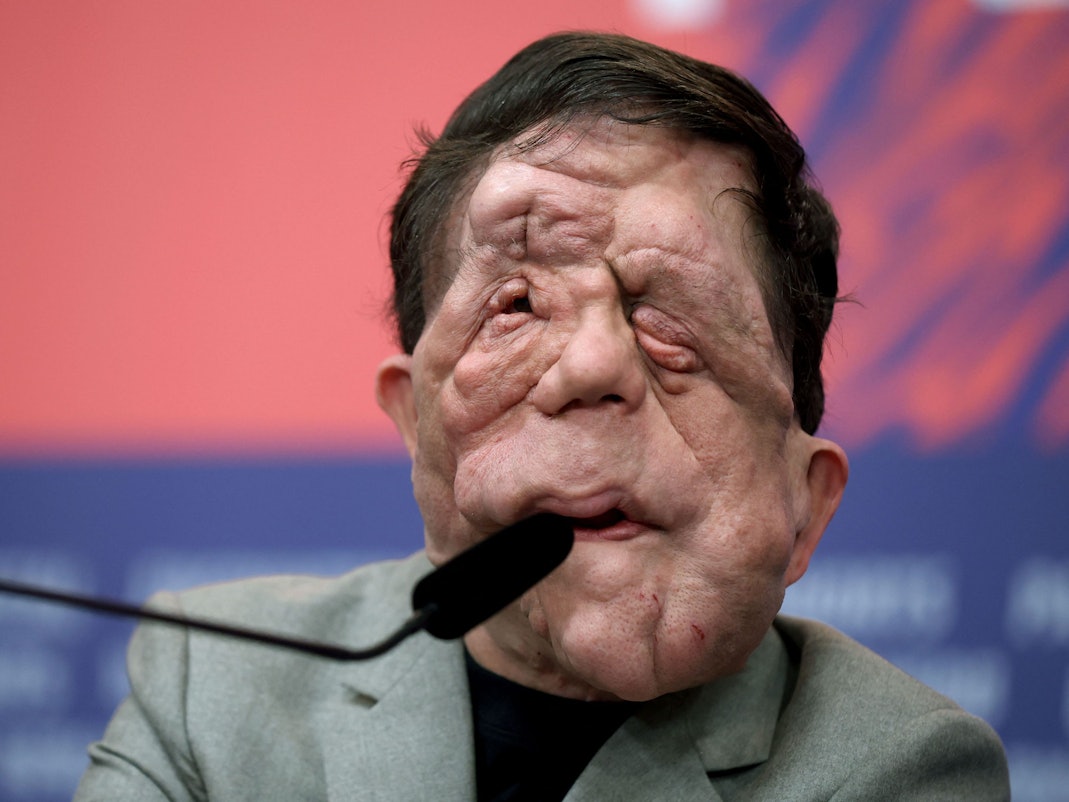 Schauspieler Adam Pearson während der Pressekonferenz zum Film „A Different Man“.