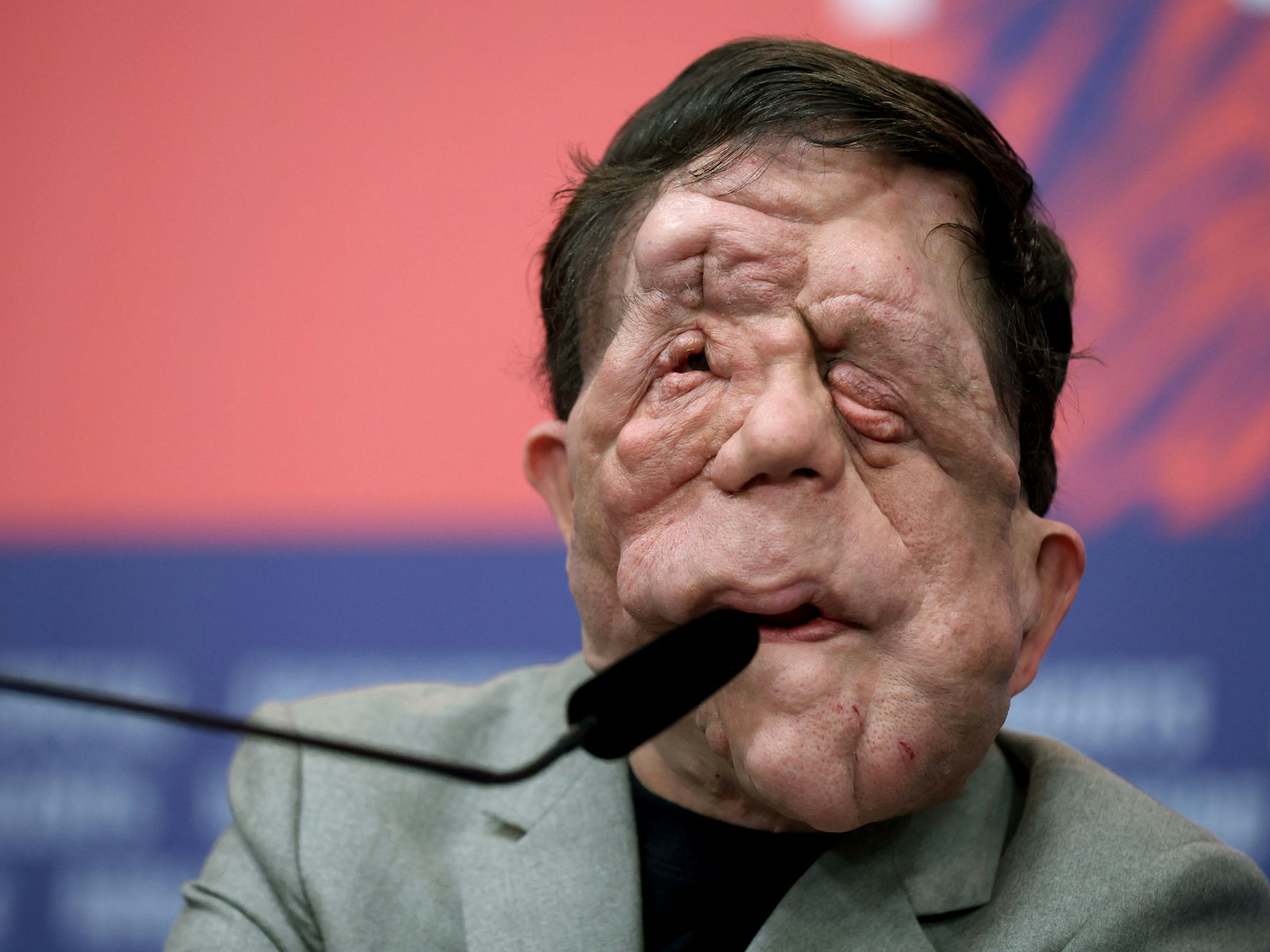 Schauspieler Adam Pearson während der Pressekonferenz zum Film „A Different Man“.