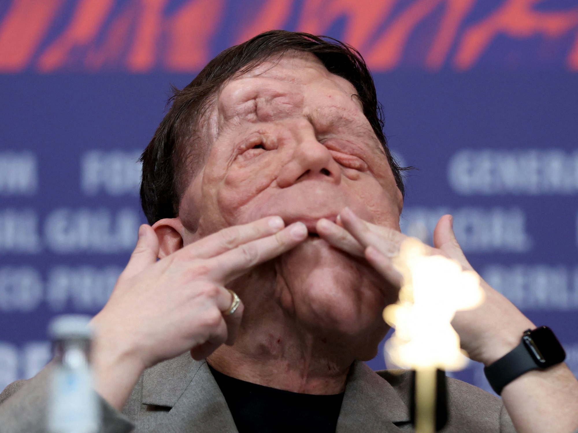 Der britische Schauspieler Adam Pearson während der Premiere seines Films „A Different Man“ auf der Berlinale am 16. Februar.