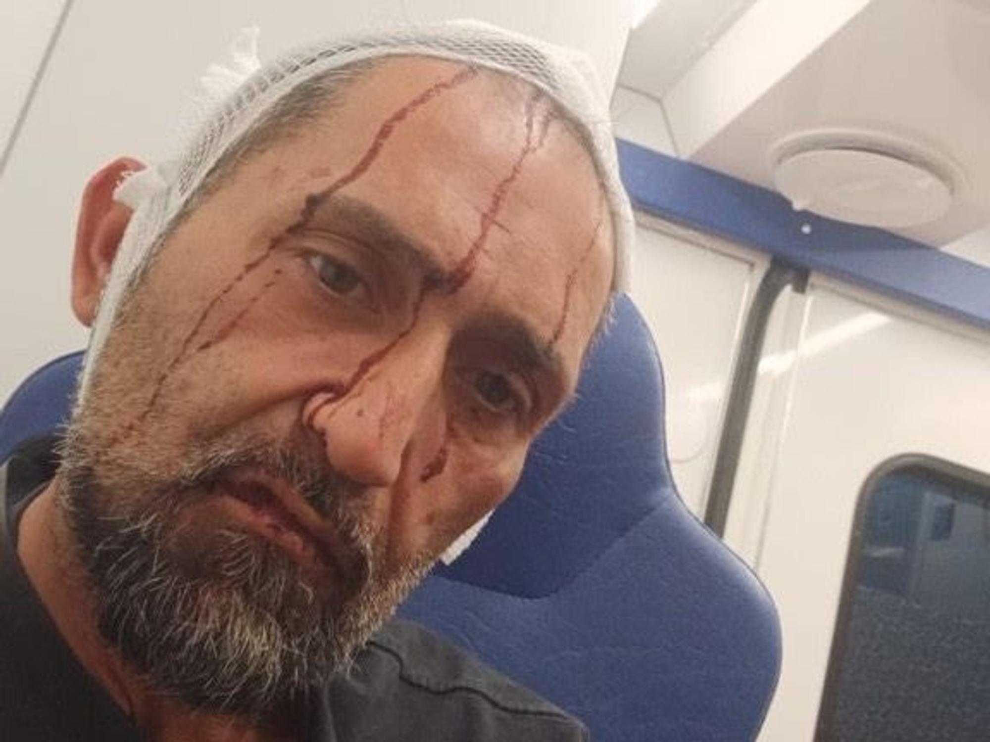 Bestatter Gökhan Yüksel sitzt mit blutüberströmtem Gesicht im Krankenwagen.