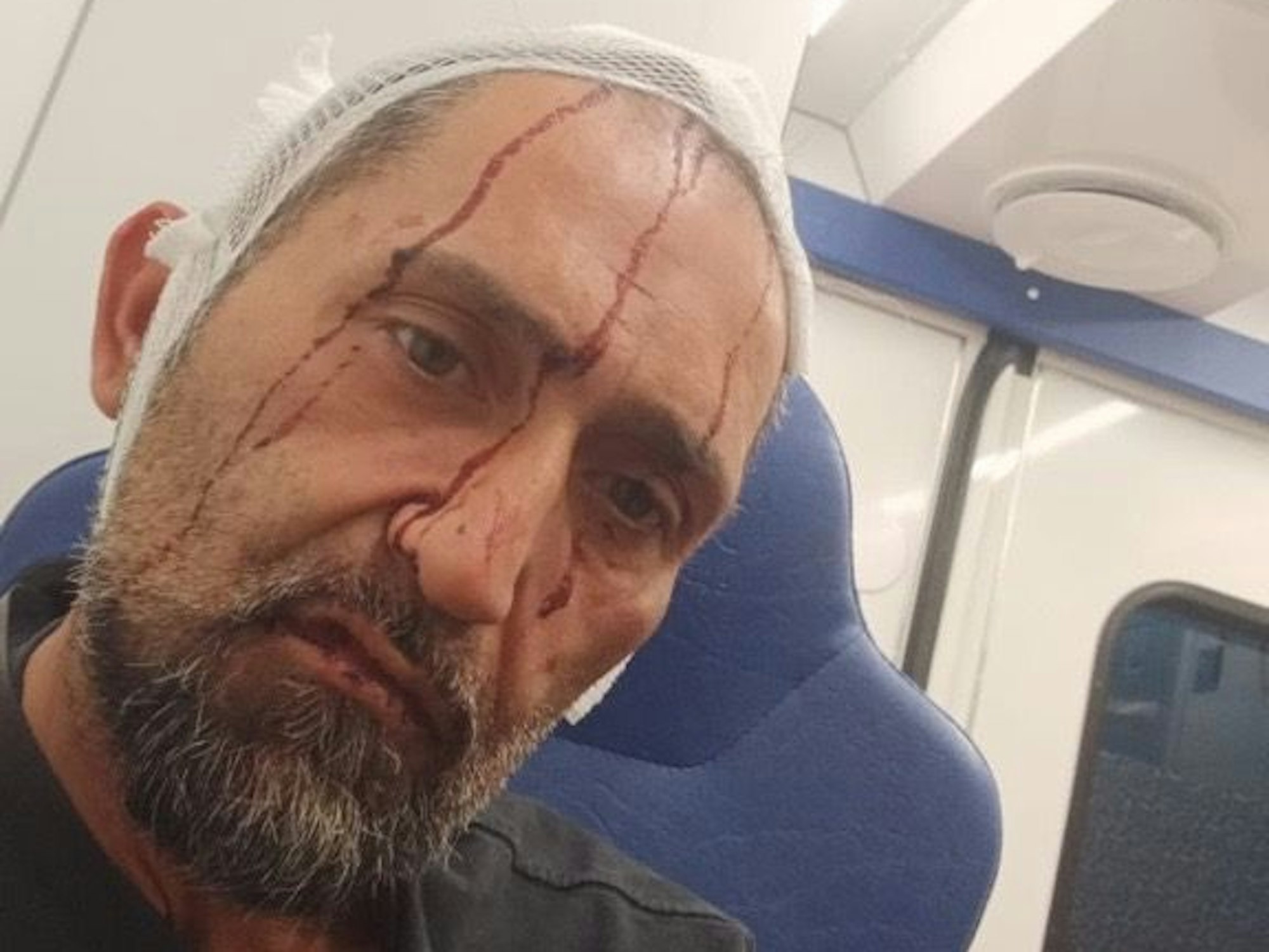 Bestatter Gökhan Yüksel sitzt mit blutüberströmtem Gesicht im Krankenwagen.