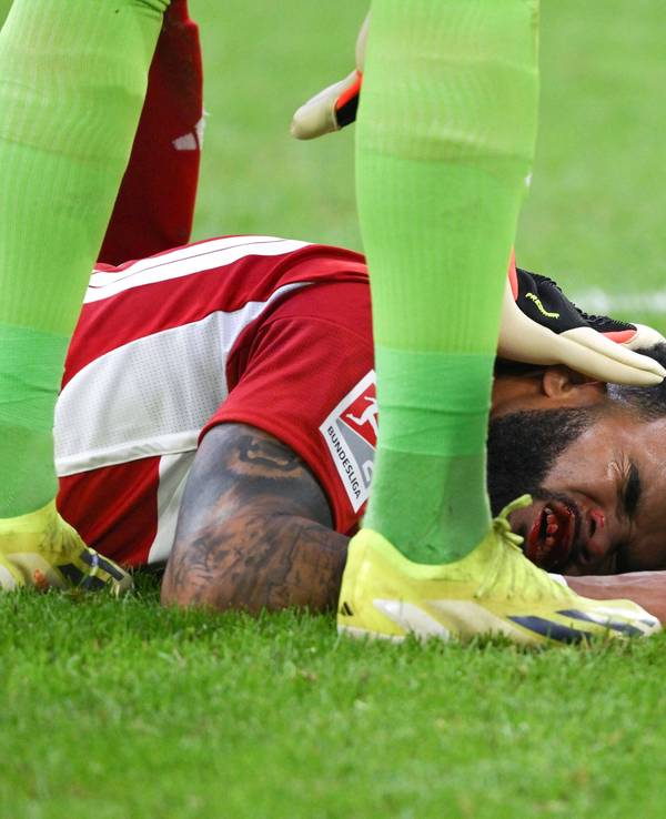Fortuna Düsseldorfs Jamil Siebert liegt im Spiel gegen den 1. FC Nürnberg mit blutendem Mund auf dem Boden.