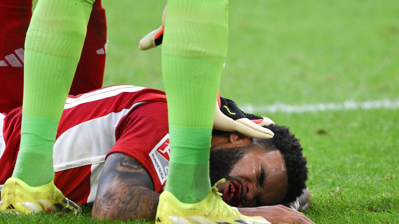 Fortuna Düsseldorfs Jamil Siebert liegt im Spiel gegen den 1. FC Nürnberg mit blutendem Mund auf dem Boden.