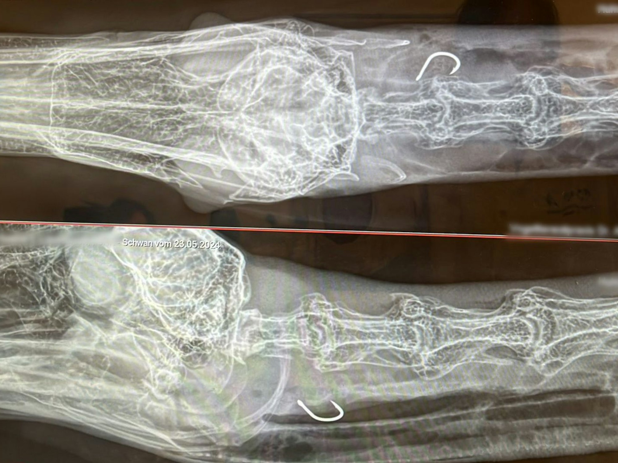 Auf zwei Röntgenbildern ist jeweils der Angelhaken zu sehen, der im Hals des Schwanes steckt.