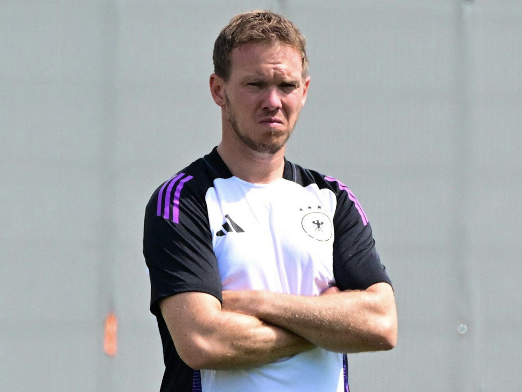 Julian Nagelsmann verschränkt die Arme.