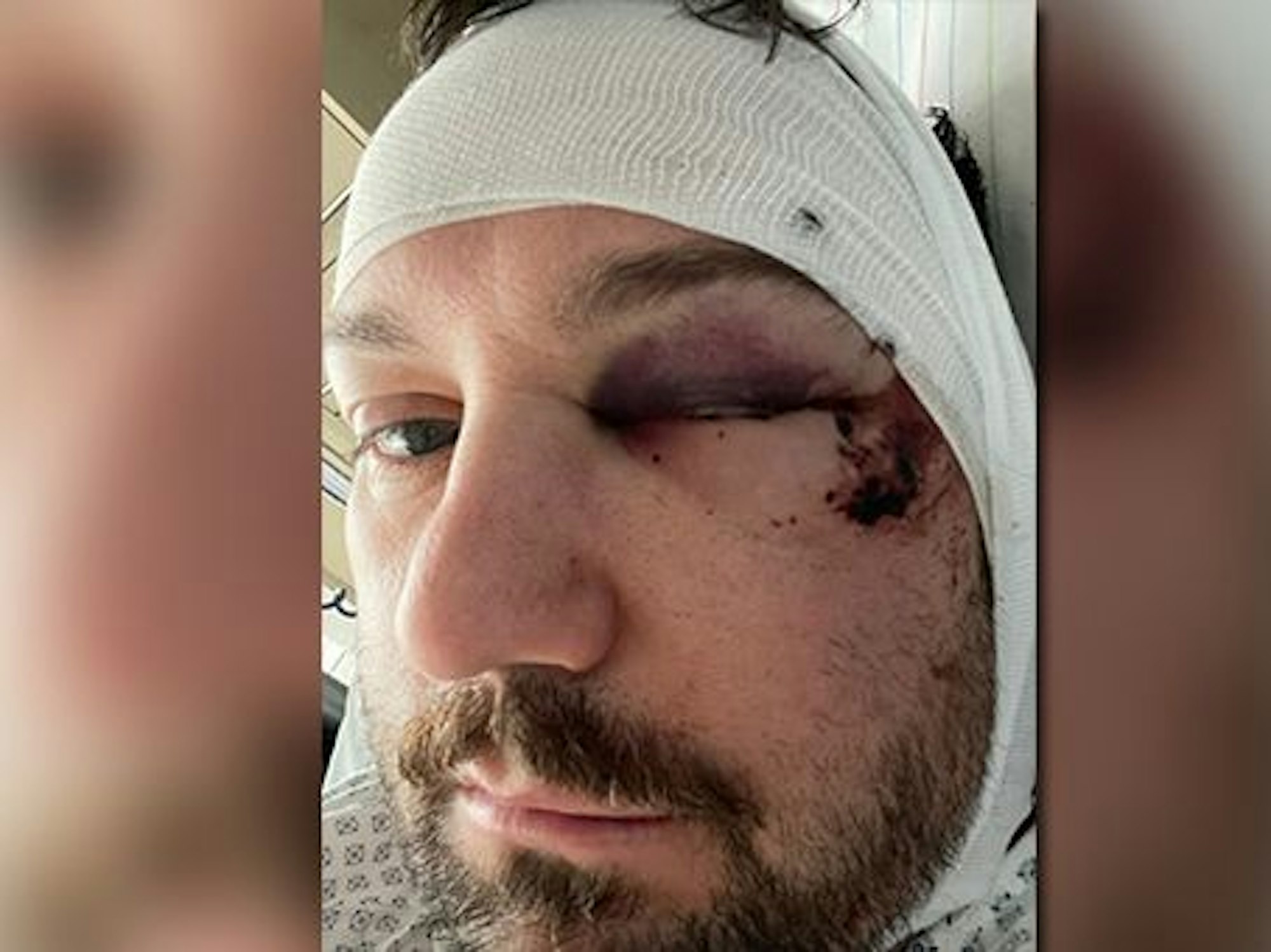 Benjamin Handrich (37) erlitt bei dem Unfall Kopfverletzungen und eine schwere Gehirnerschütterung.