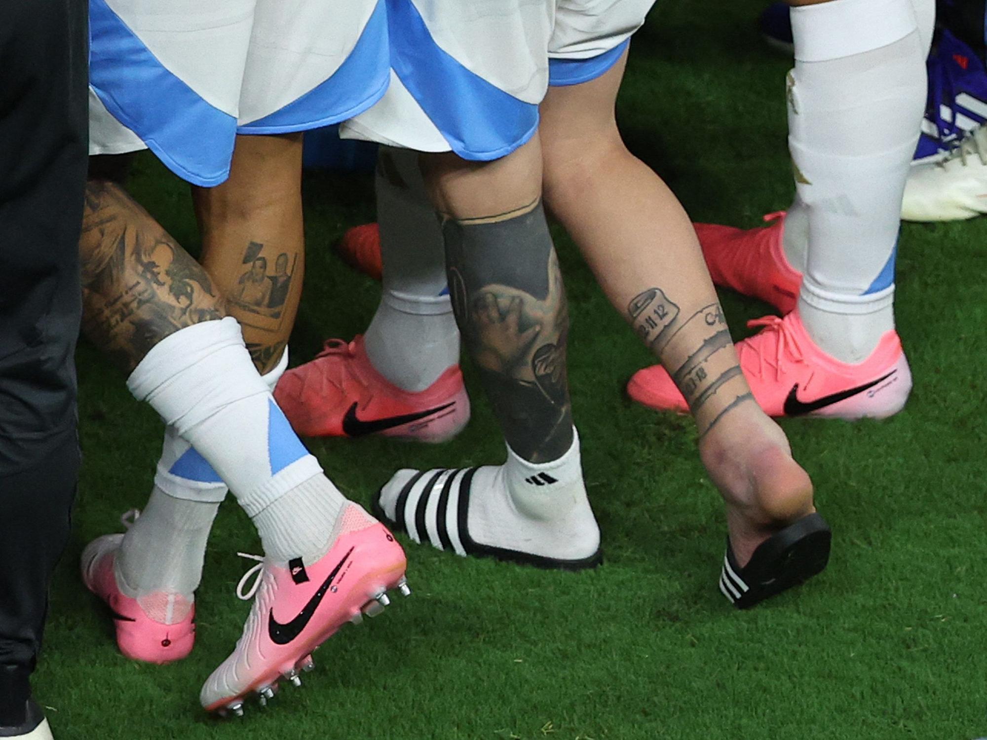 Autsch! Der rechte Knöchel von Lionel Messi war nach seiner Auswechslung beim Copa-Finale stark angeschwollen.