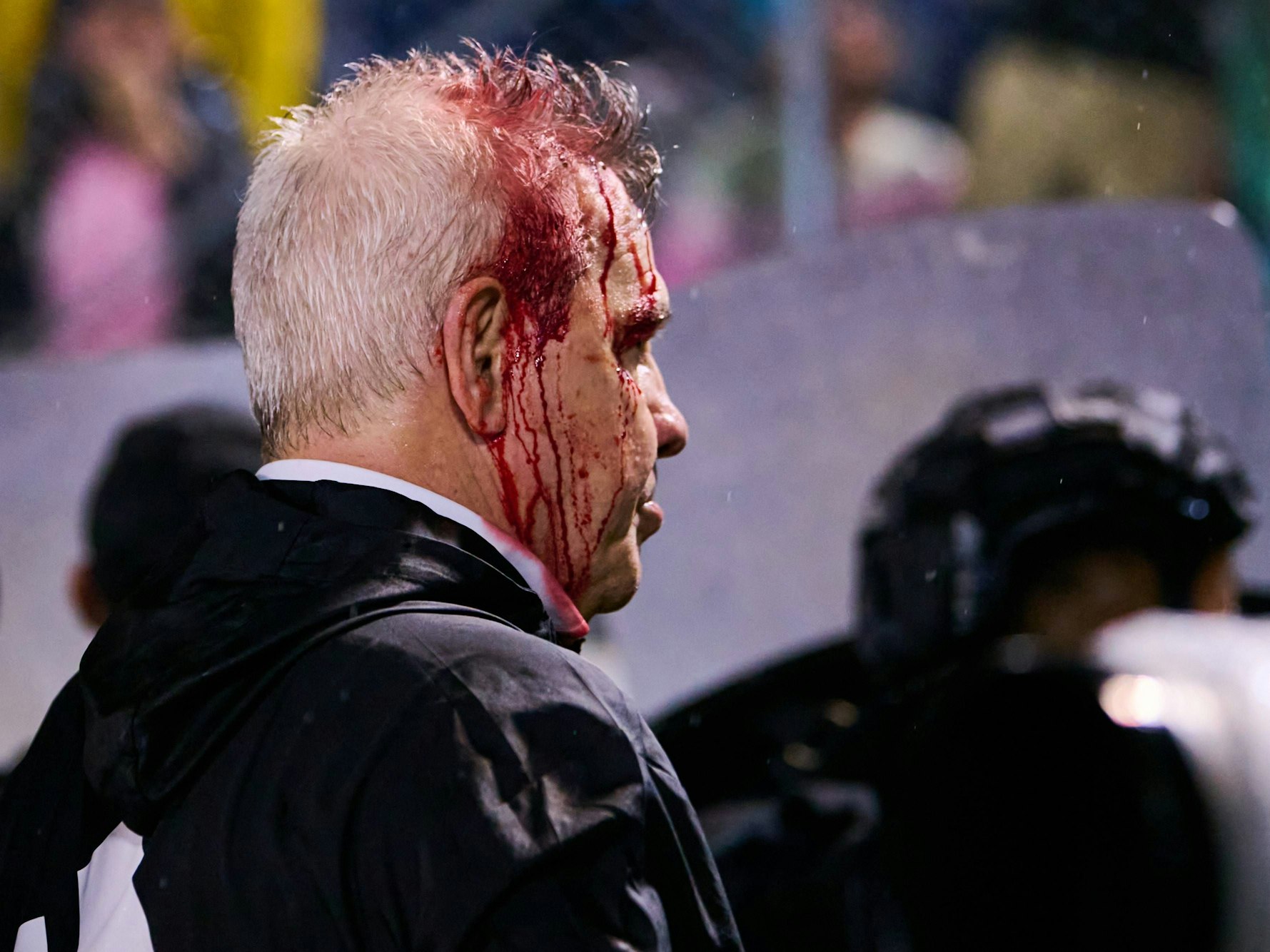 Javier Aguirre blutet am Kopf.