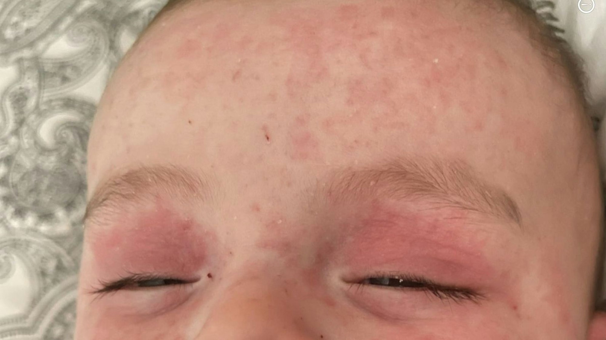 Der einjährige Sohn der Ünsals hat immer wieder mit gesundheitlichen Problemen zu kämpfen – auch aufgrund der Zustände in ihrer Wohnung.