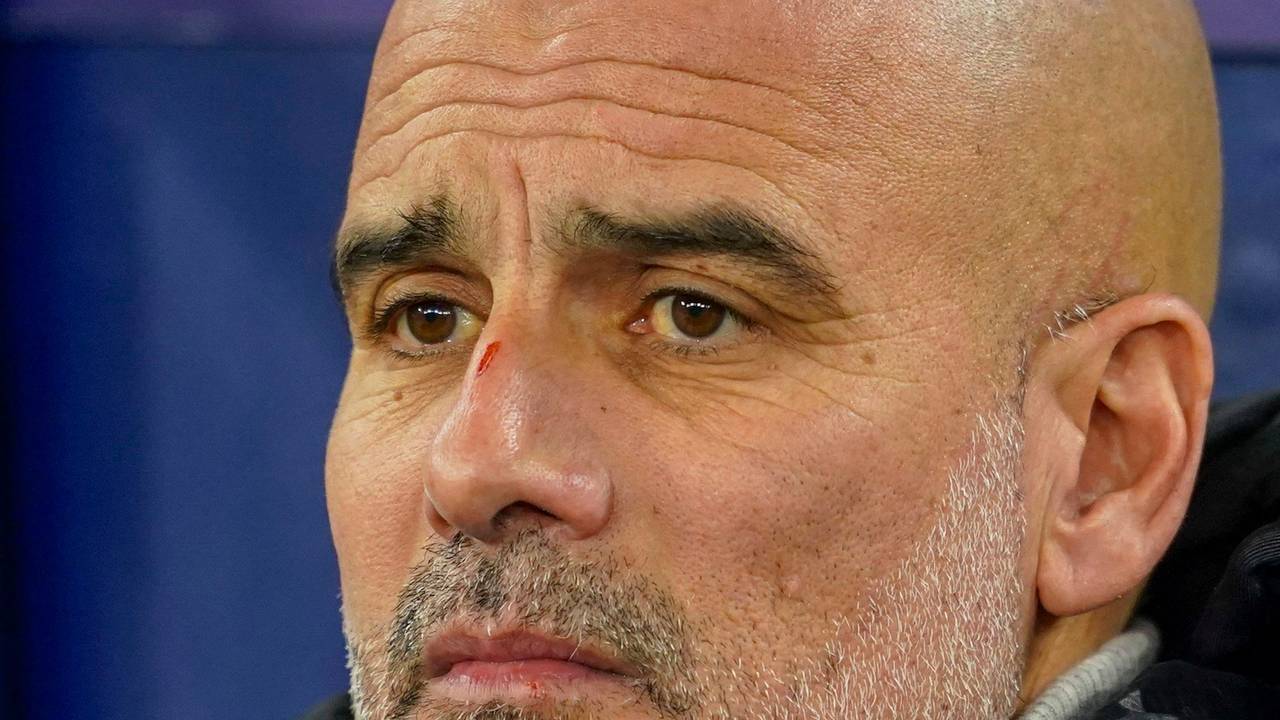 Pep Guardiola beim Champions-League-Spiel von Manchester City gegen Feyenoord Rotterdam am Dienstag (26. November 2024) mit der Wunde auf der Nase.