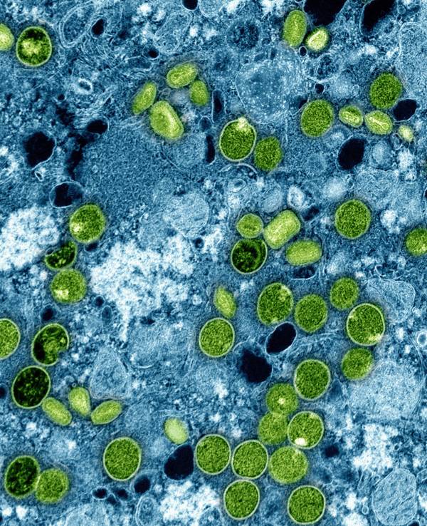 Diese kolorierte elektronenmikroskopische Aufnahme des National Institute of Allergy and Infectious Diseases aus dem Jahr 2024 zeigt Mpox-Viruspartikel (grün), die sich in infizierten kultivierten Zellen (blau) befinden.