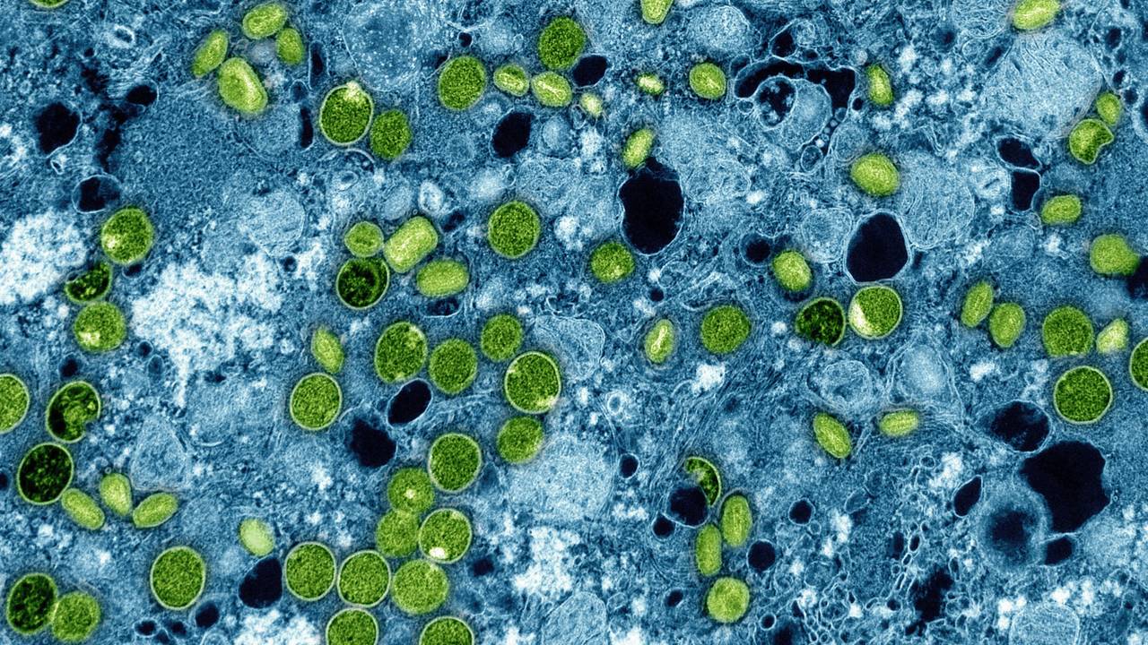 Diese kolorierte elektronenmikroskopische Aufnahme des National Institute of Allergy and Infectious Diseases aus dem Jahr 2024 zeigt Mpox-Viruspartikel (grün), die sich in infizierten kultivierten Zellen (blau) befinden.