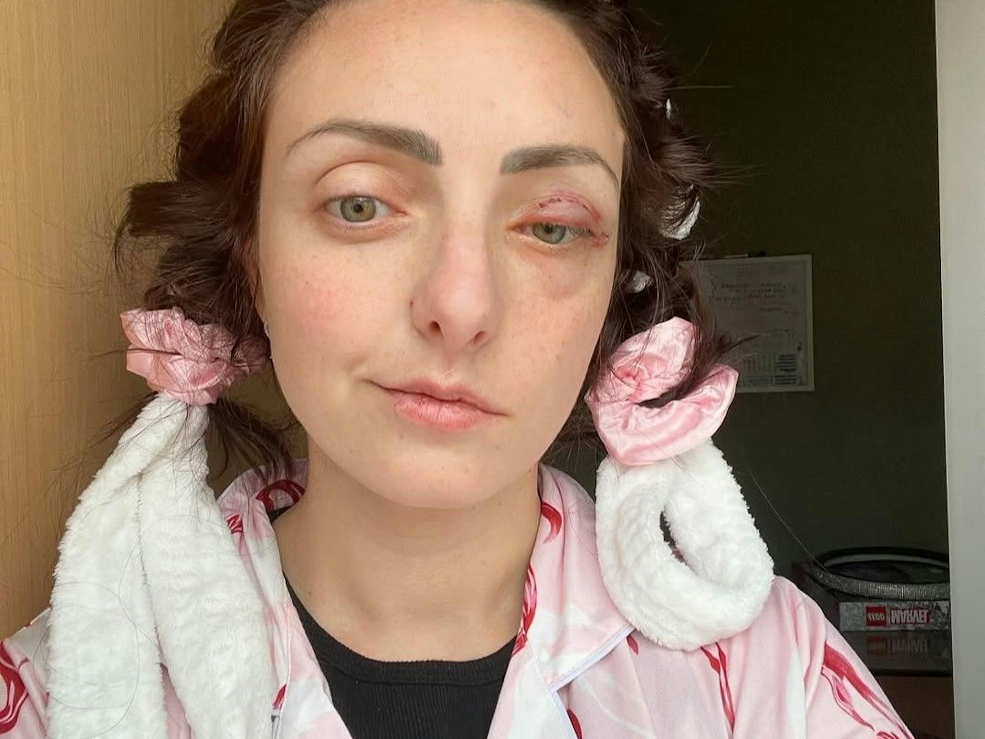 Eine Mutter zweier Kinder hatte ihr zuckendes Auge zunächst als Stress abgetan und war schockiert, als sie erfuhr, dass es sich tatsächlich um einen seltenen Gehirntumor handelte.