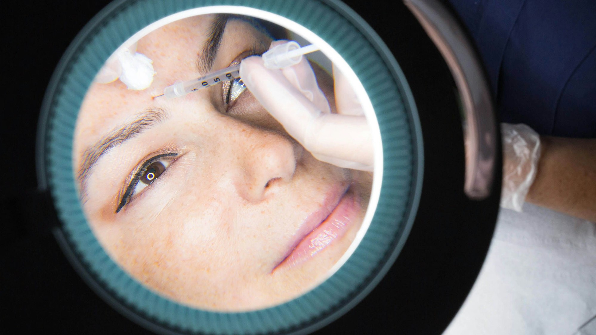 Eine Frau erhält eine Botox-Injektion (undatierte Aufnahme).