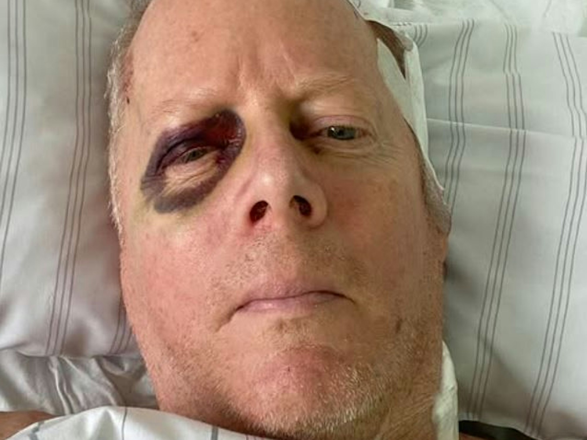 Der Kölner Comedian John Doyle ist in Düsseldorf schwer gestürzt.