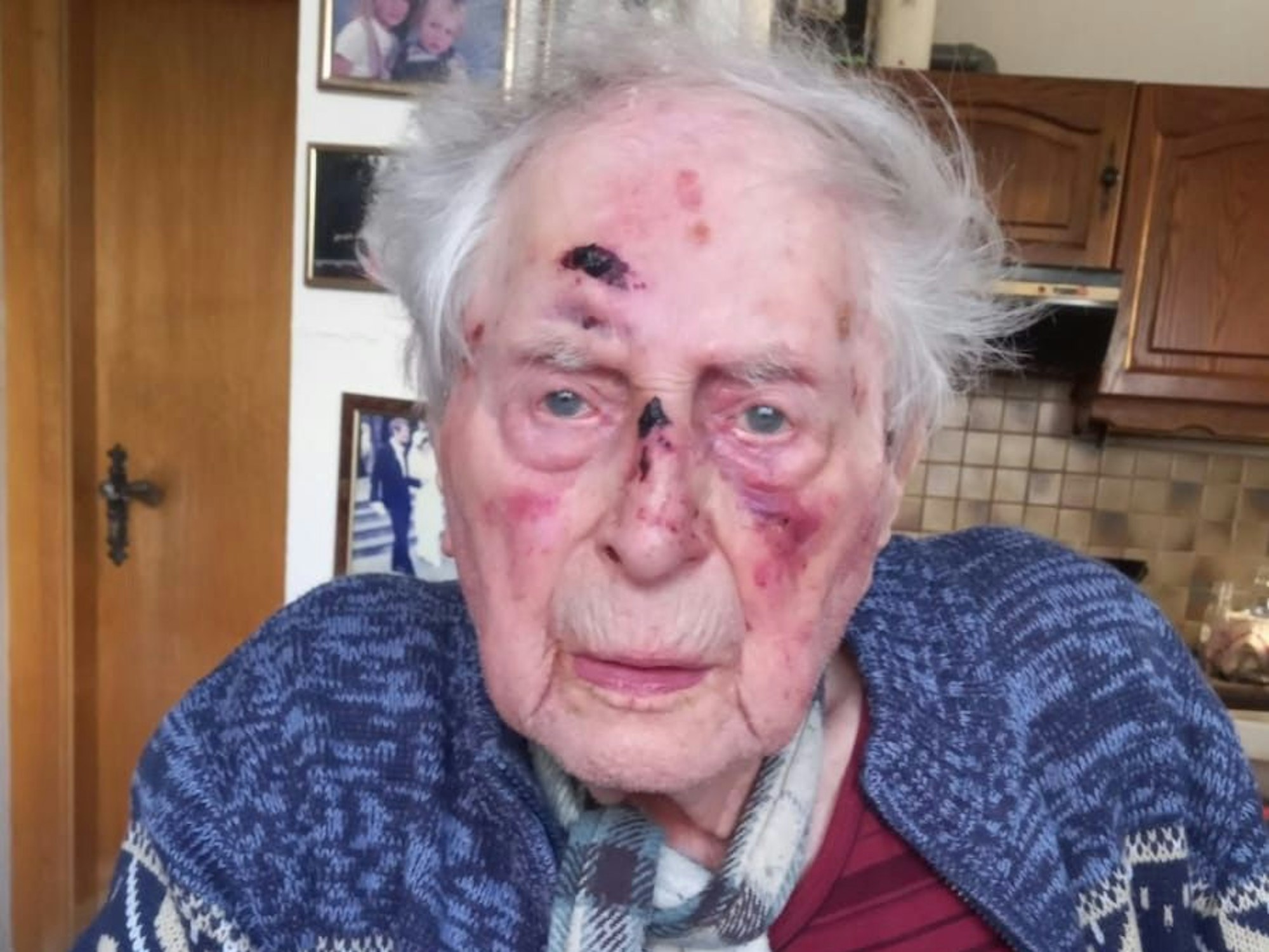 Foto von Ludwig Sebus nach dessen Sturz.