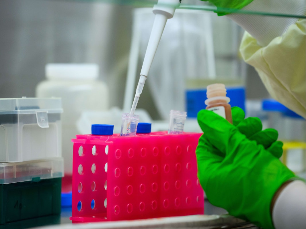 Chinesische Forschende haben neue Eigenschaften eines Coronavirus entdeckt