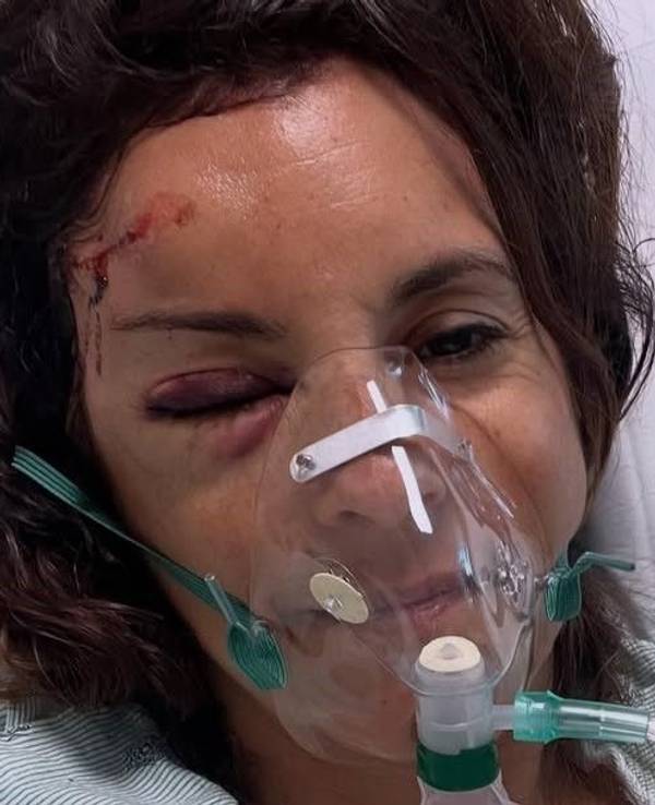 Marion Grosjean liegt intubiert im Krankenhaus.