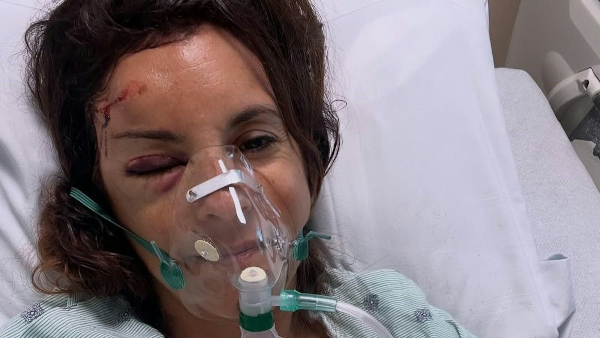 Marion Grosjean liegt intubiert im Krankenhaus.