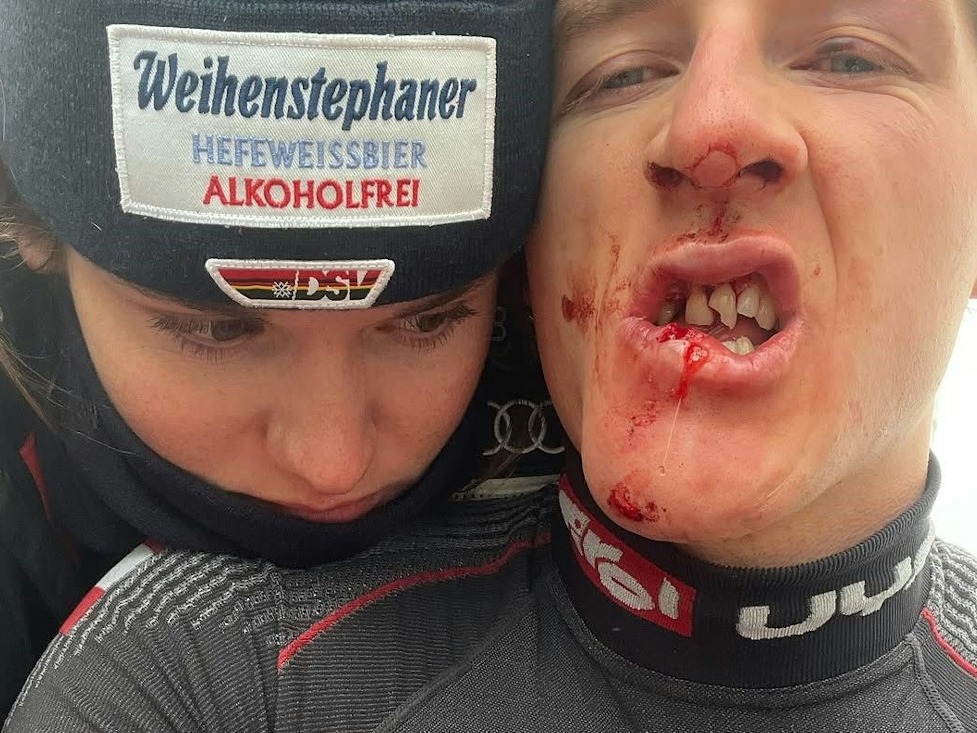 Fabiana Dorigo tröstet ihren im Gesicht verletzten Freund.