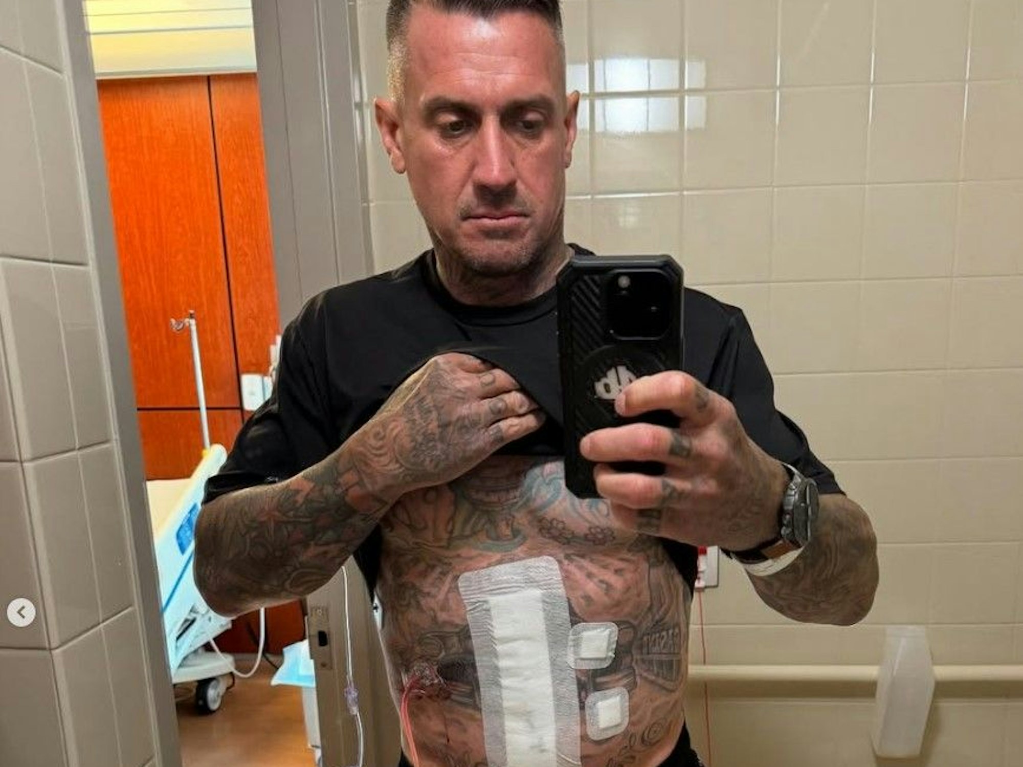 Pink-Ehemann Carey Hart zeigt seine Verletzung.