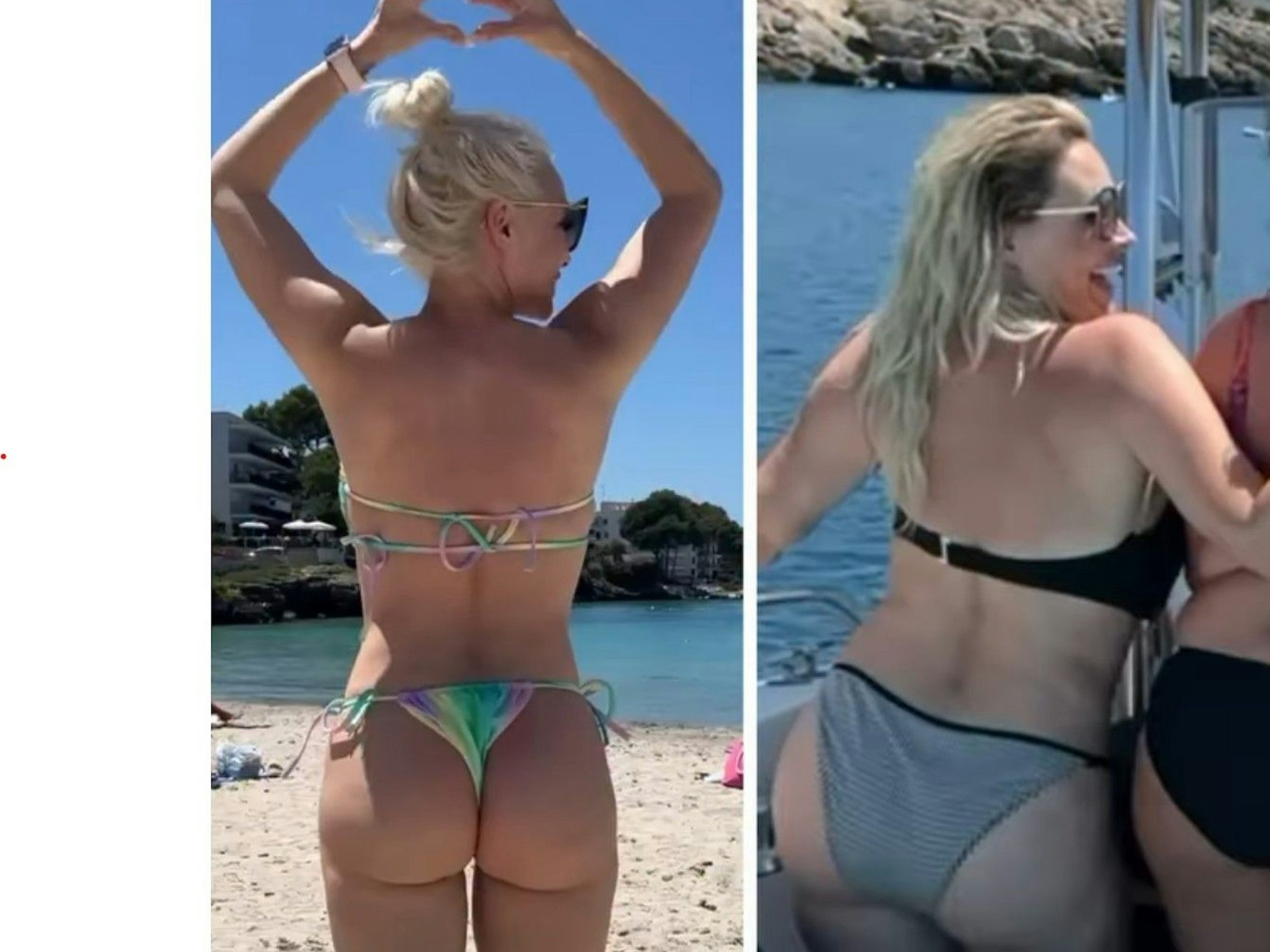 Daniela Katzenberger mit einem vorher-nachher-Vergleich ihrer Kehrseite.