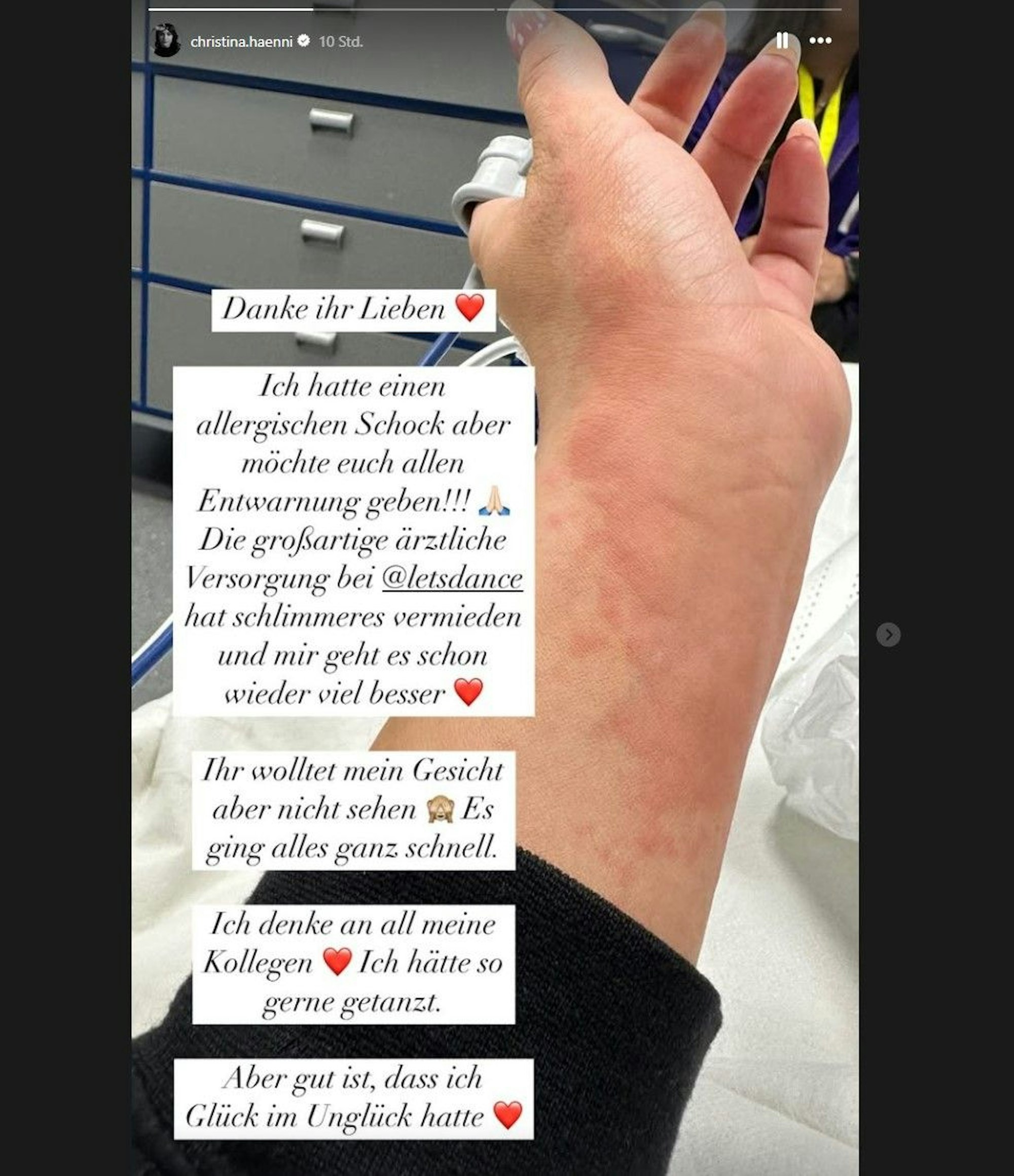 In ihrer Instagramstory zeigte Christina Hänni ihren geröteten und geschwollenen Arm.