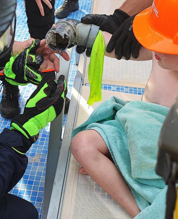 Der angesaugte Arm des Jungen steckt in einem Rohr.