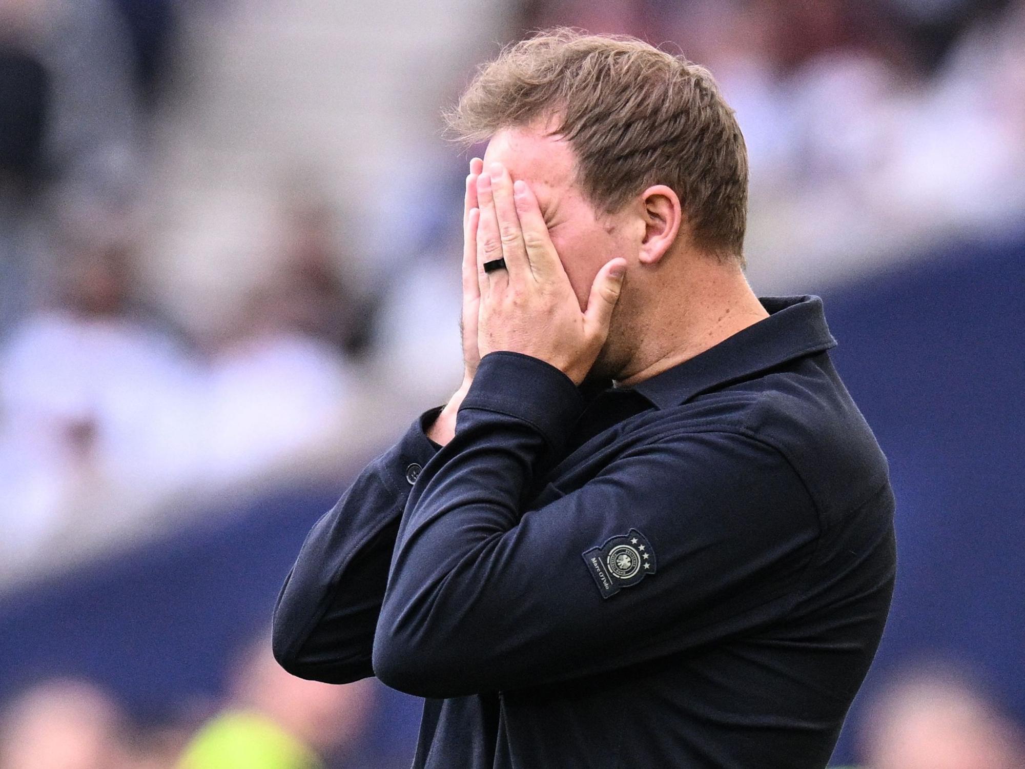 Julian Nagelsmann schlägt die Hände vors Gesicht.