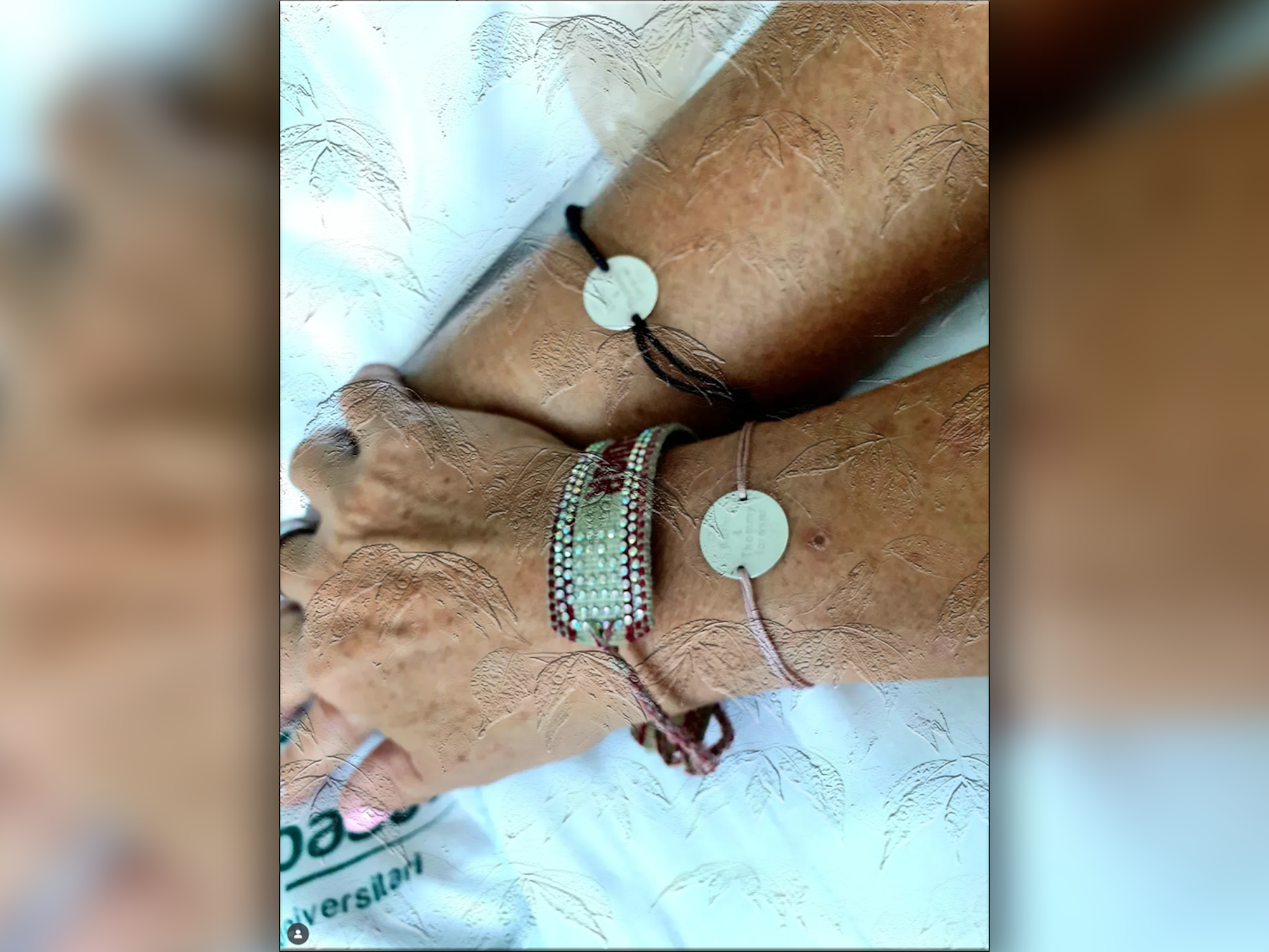 Kathrin Mermi-Schmelz hält fest die Hand ihres Partners, Thommy Schmelz. Der TV-Auswanderer liegt seit einigen Tagen im künstlichen Koma, erklärt sie.