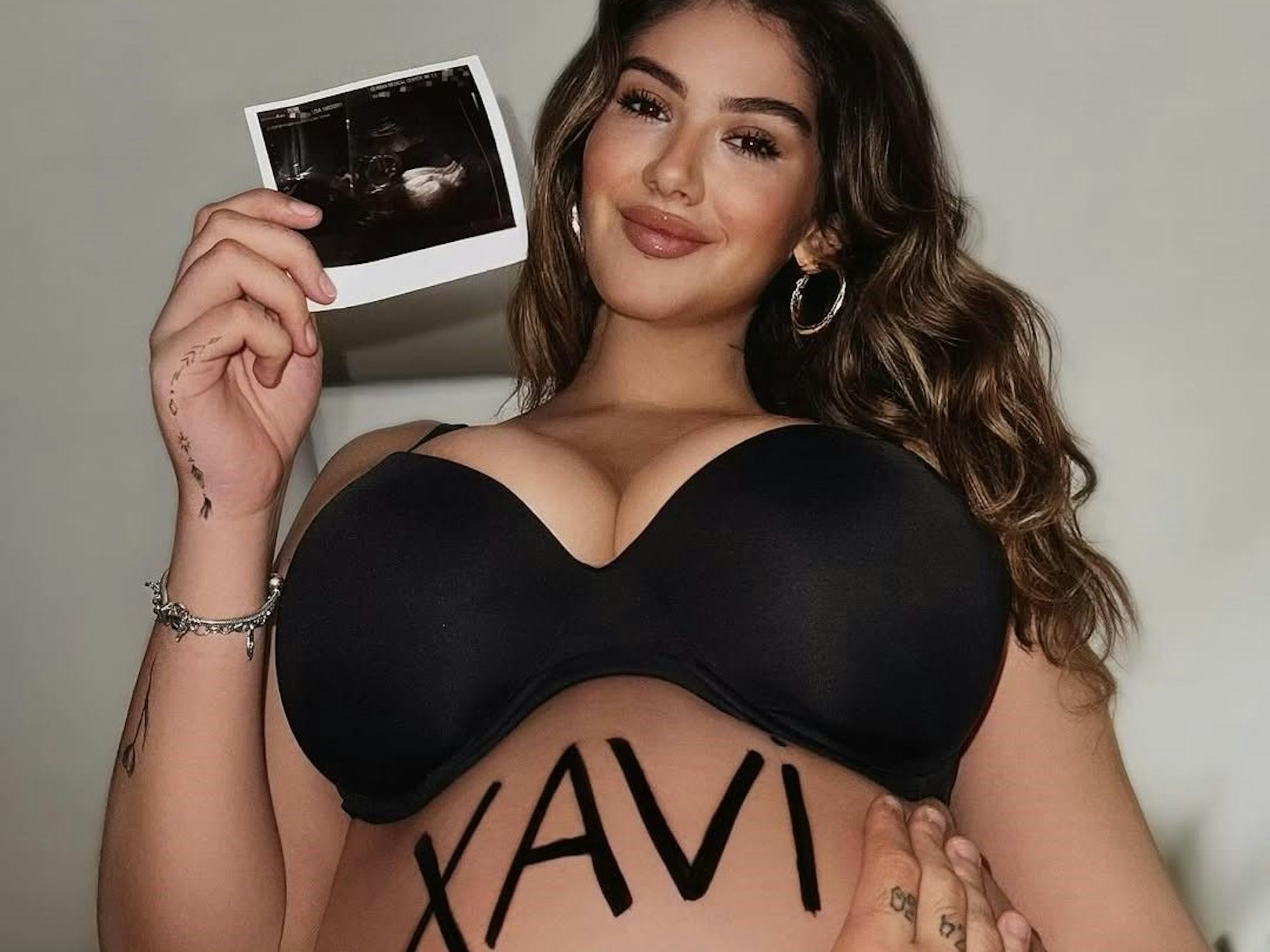 Noch vor fünf Wochen war die Freude groß über ihr zweites Kind. Nun bangt Lisa Straube um die Gesundheit.