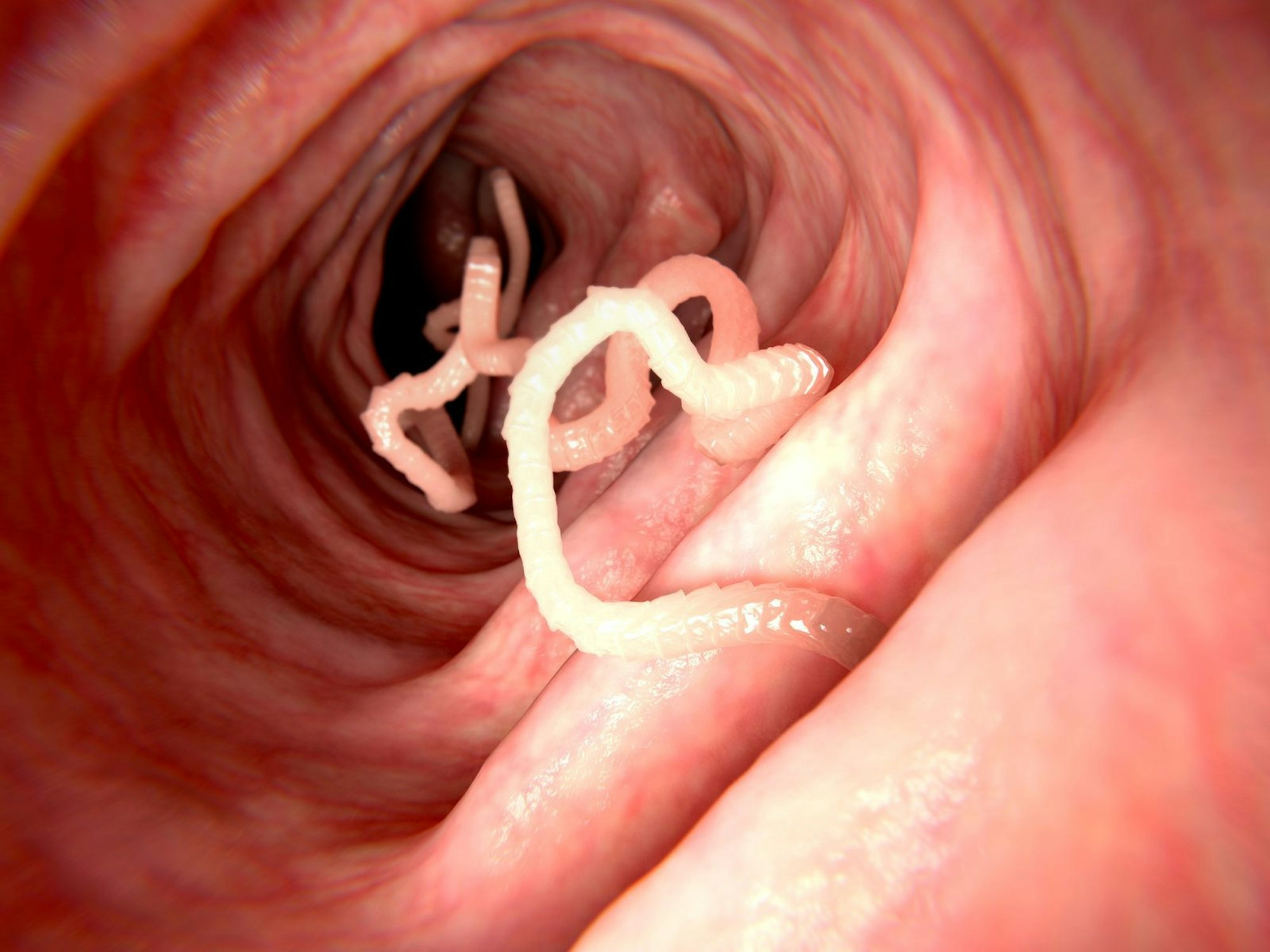 Eine Infektion mit dem Fuchsbandwurm bleibt meist lange unbemerkt. (Bild: iStock/selvanegra)