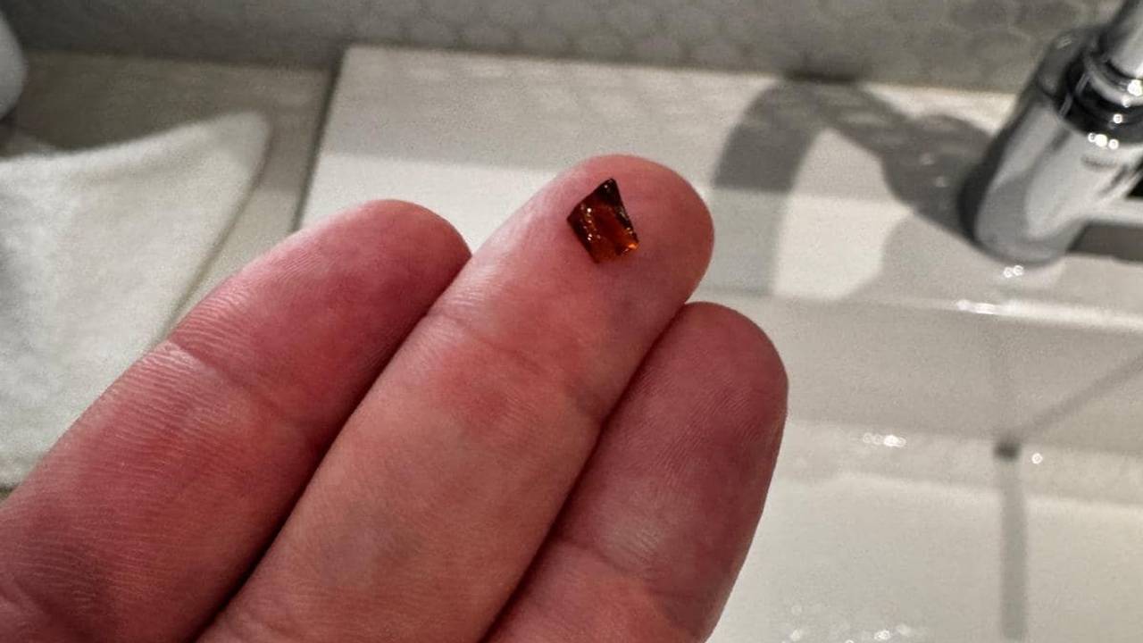 Ein Glassplitter, den Monika Dohmen runterschluckte.
