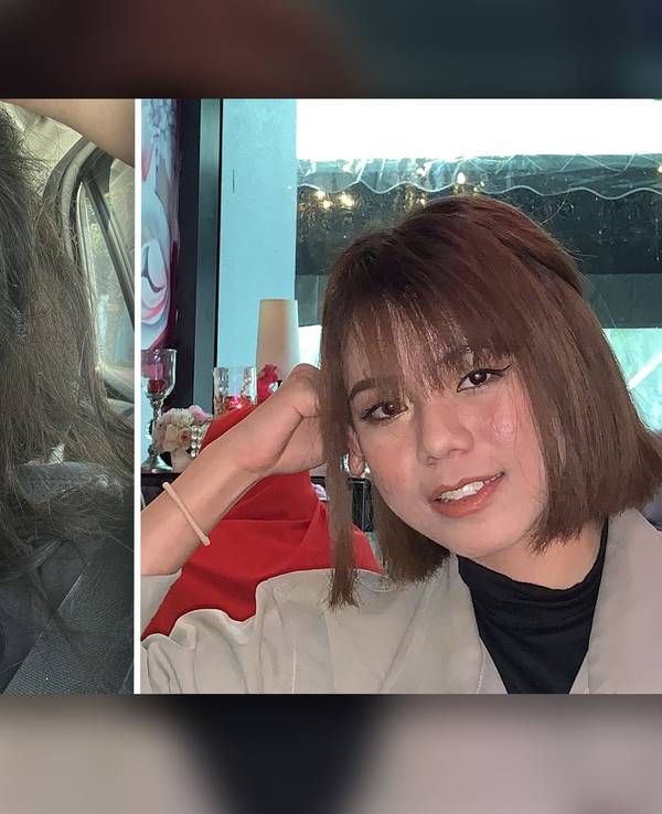 Farah Faizal postete auf X ungefilterte Fotos von sich, um zu zeigen, wie sehr sich ihr Gesicht vor und nach der Schwangerschaft verändert hatte.