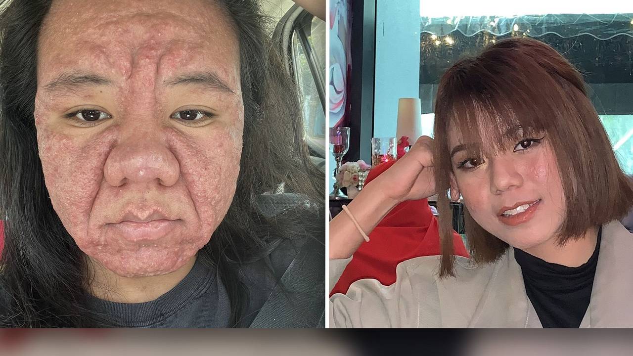 Farah Faizal postete auf X ungefilterte Fotos von sich, um zu zeigen, wie sehr sich ihr Gesicht vor und nach der Schwangerschaft verändert hatte.