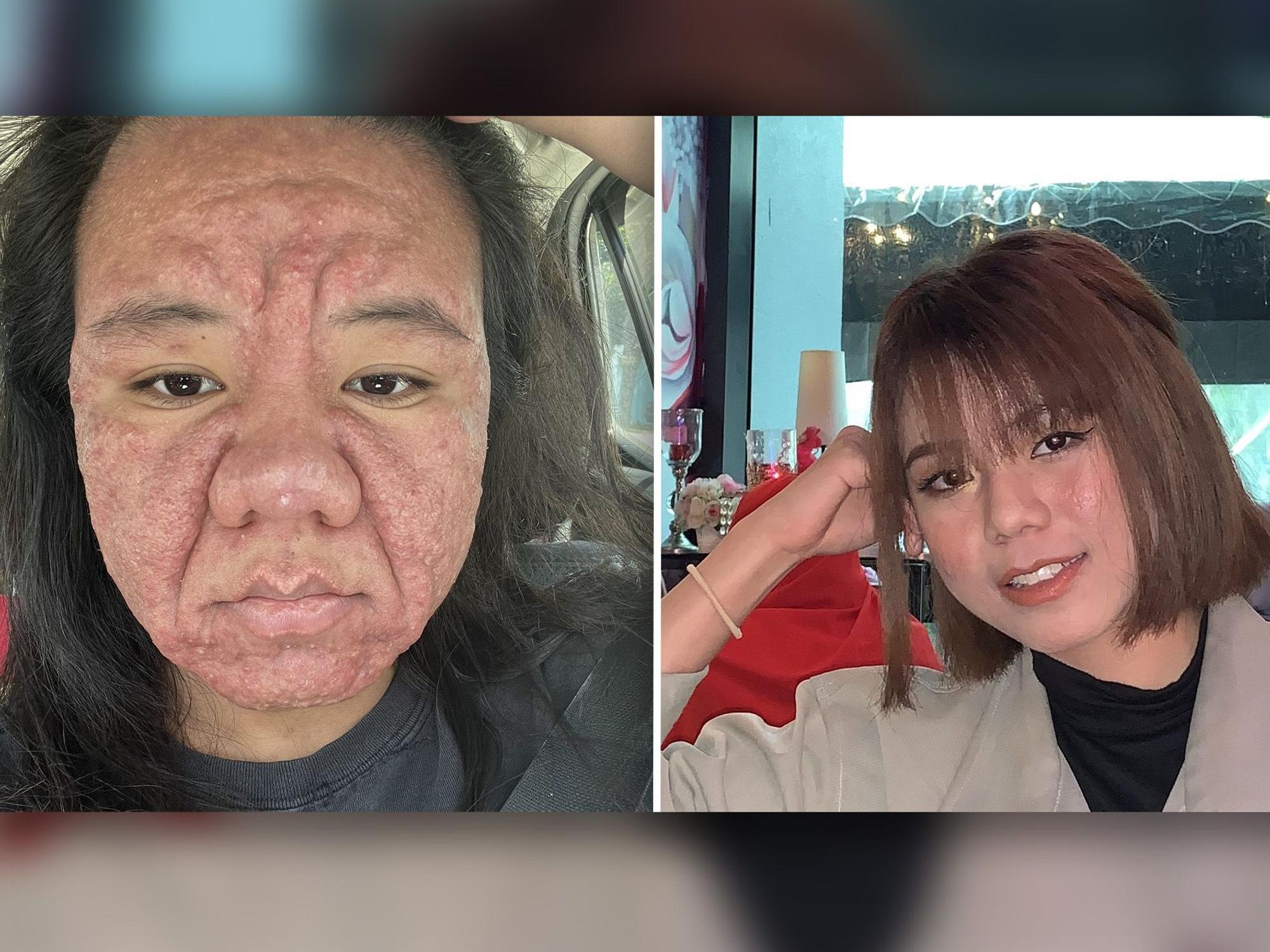 Farah Faizal postete auf X ungefilterte Fotos von sich, um zu zeigen, wie sehr sich ihr Gesicht vor und nach der Schwangerschaft verändert hatte.