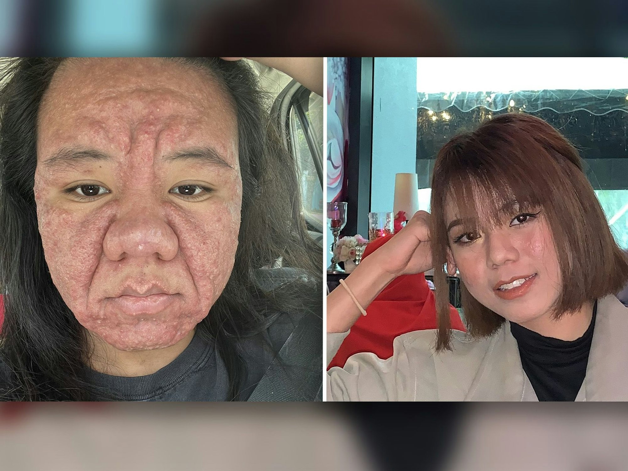 Farah Faizal postete auf X ungefilterte Fotos von sich, um zu zeigen, wie sehr sich ihr Gesicht vor und nach der Schwangerschaft verändert hatte.
