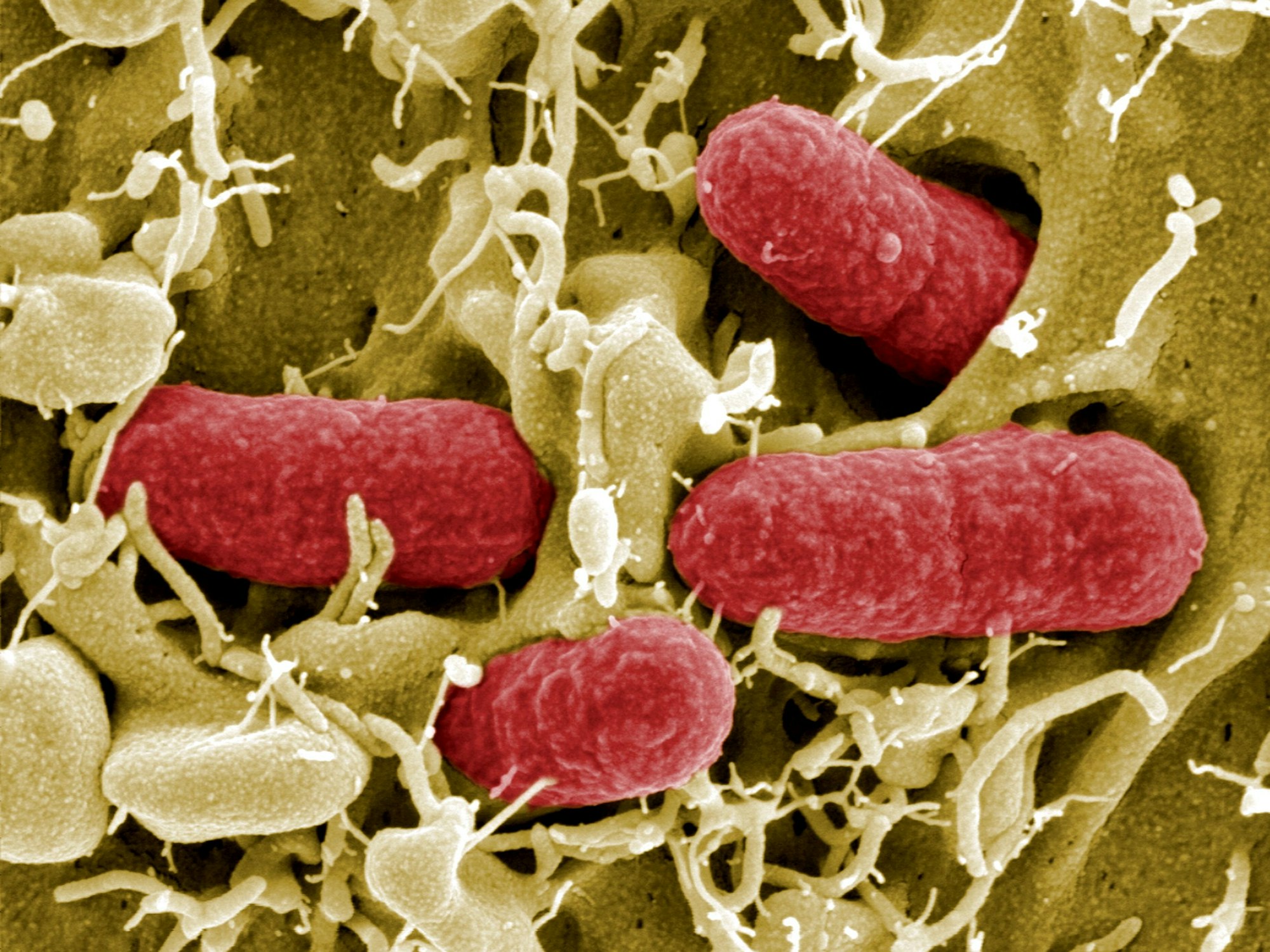 Das undatierte Foto vom Helmholtz-Zentrum für Infektionsforschung (HZI) zeigt die elektronenmikroskopische Aufnahme von EHEC-Bakterien.