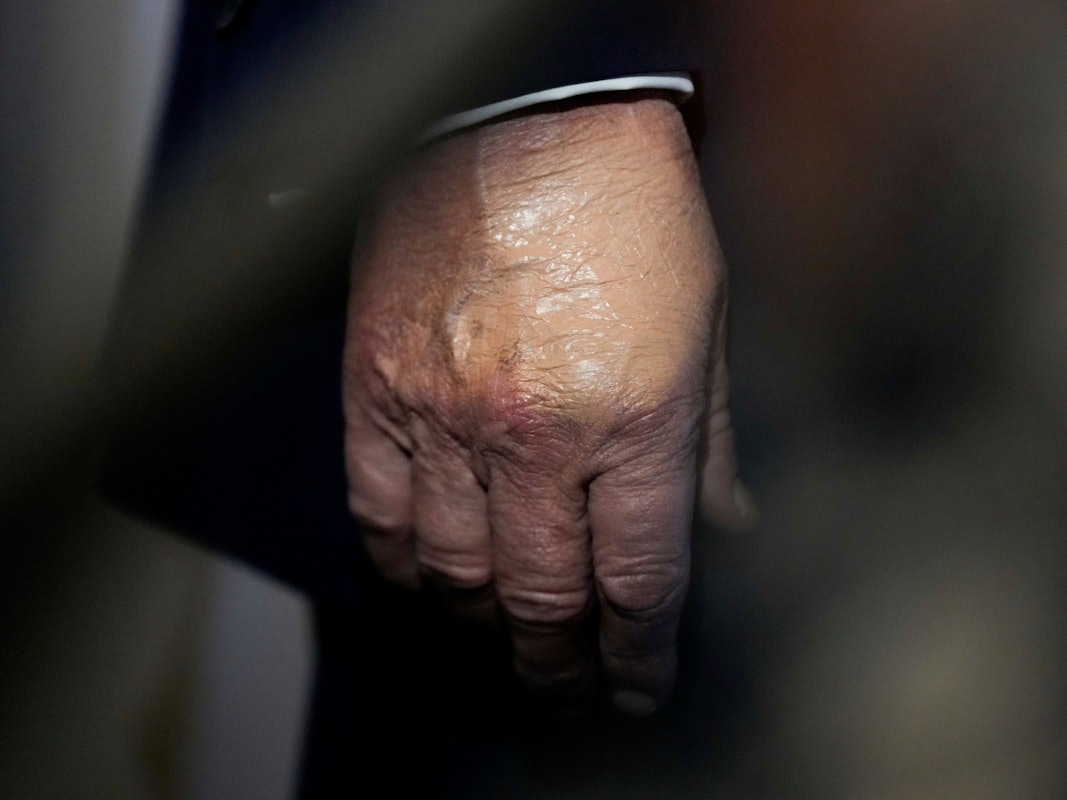 US-Präsident Donald Trump trägt Make-up an der Hand, als er an Bord der Air Force One zu Reportern spricht.