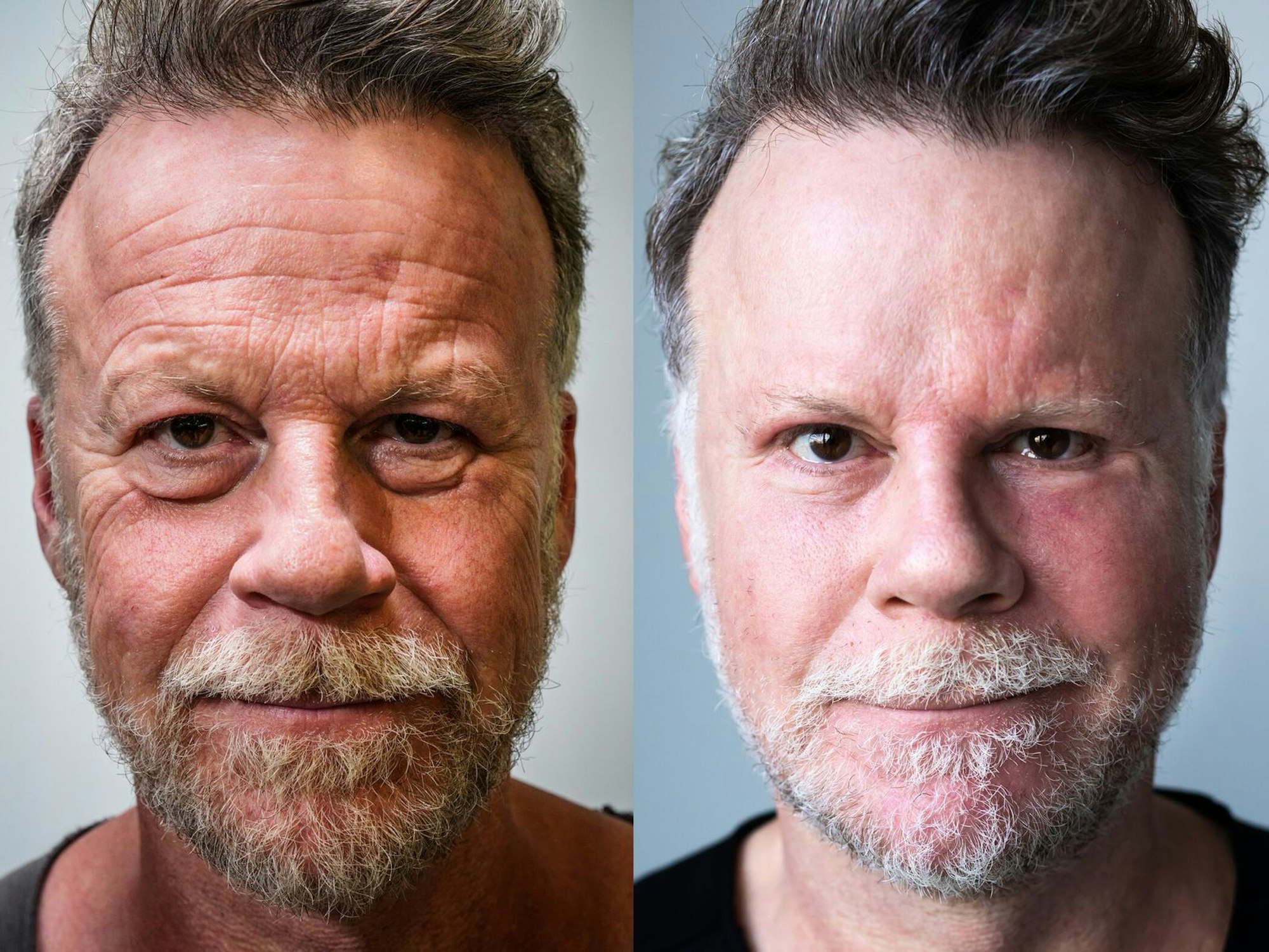 Mit seinem „Schönheits-Experiment“ machte Jenke von Wilmsdorff Schlagzeilen wie mit keinem anderen Selbstversuch.