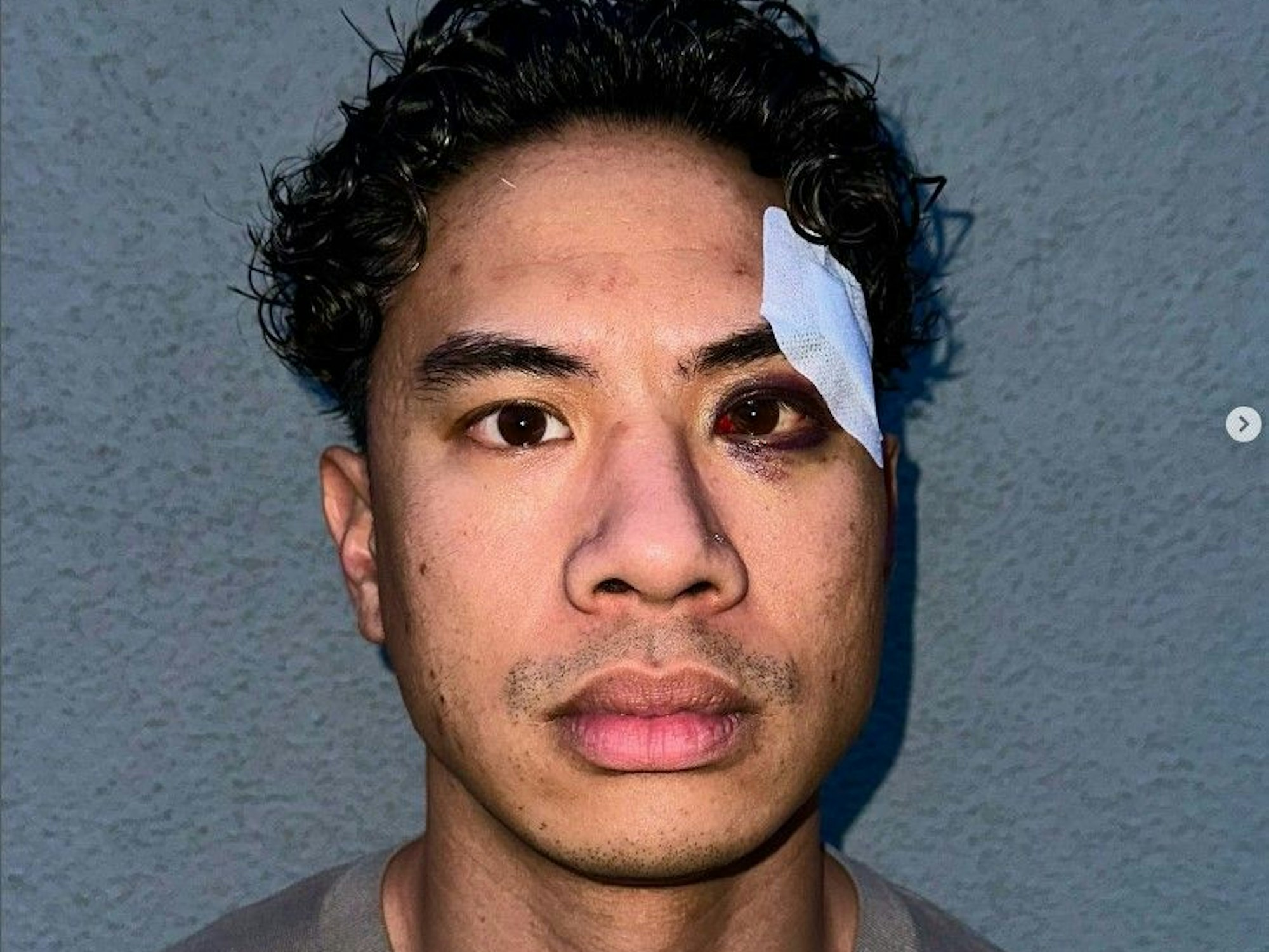 Tutty Tran wurde angegriffen.