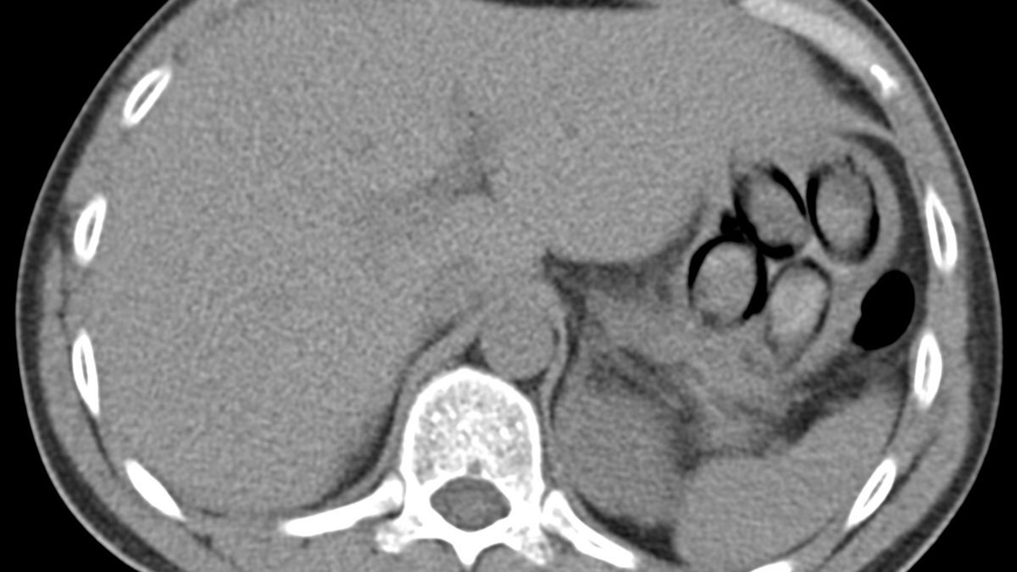Sichergestellte Kokain-Päckchen liegen aufgereiht auf einem Tisch.