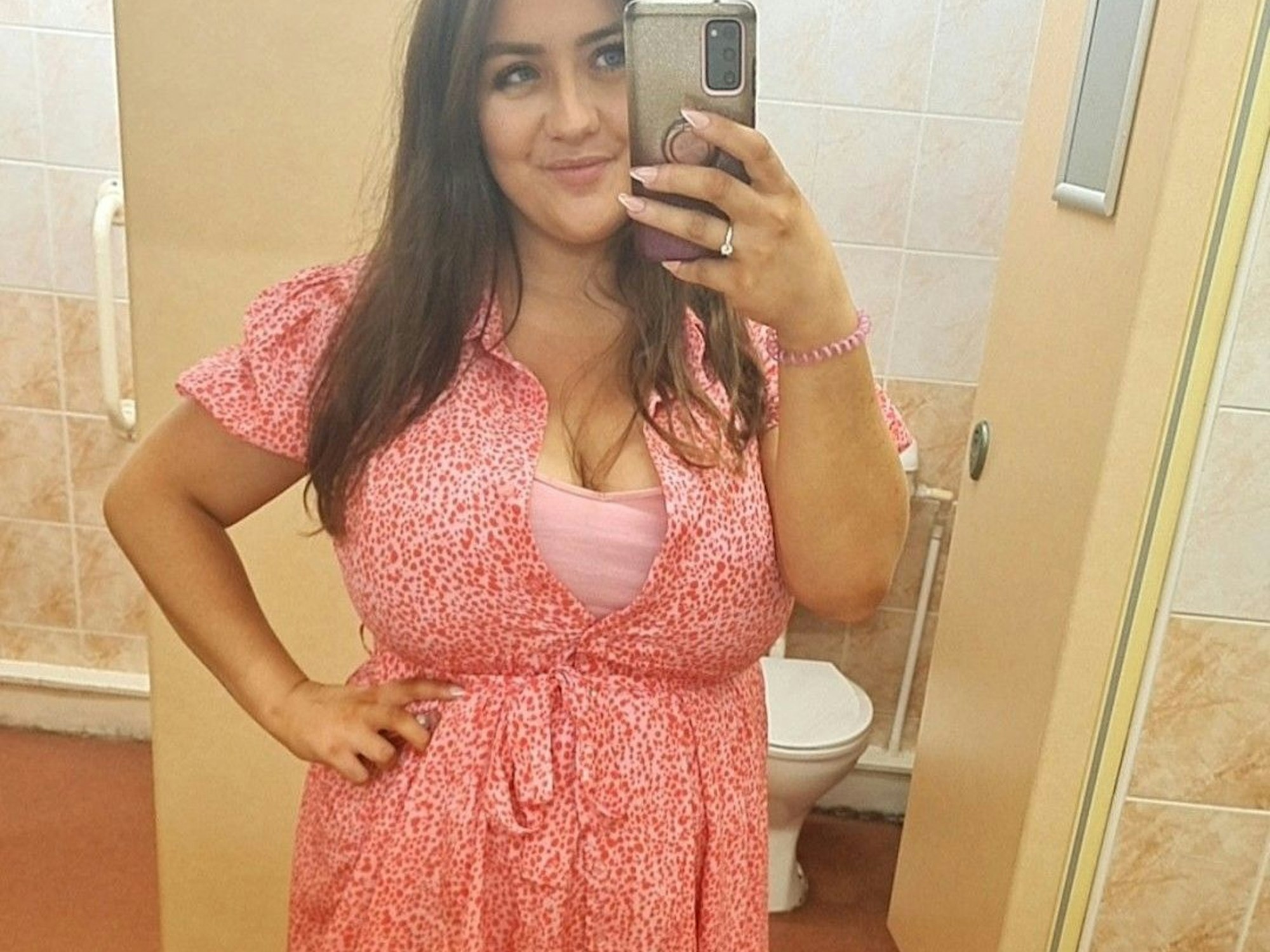 Wünscht sich eine Brustverkleinerung: Melissa Ashcroft