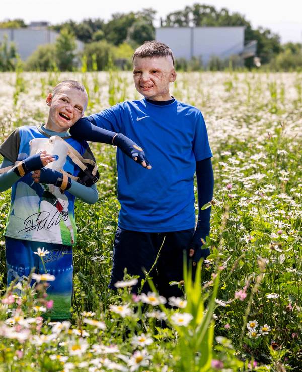 Zwei von Verletzungen gezeichnete Jungs stehen lachend in einem Feld voller Blumen.