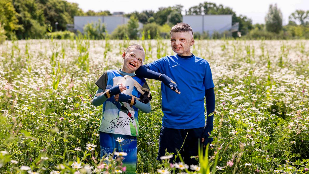 Zwei von Verletzungen gezeichnete Jungs stehen lachend in einem Feld voller Blumen.