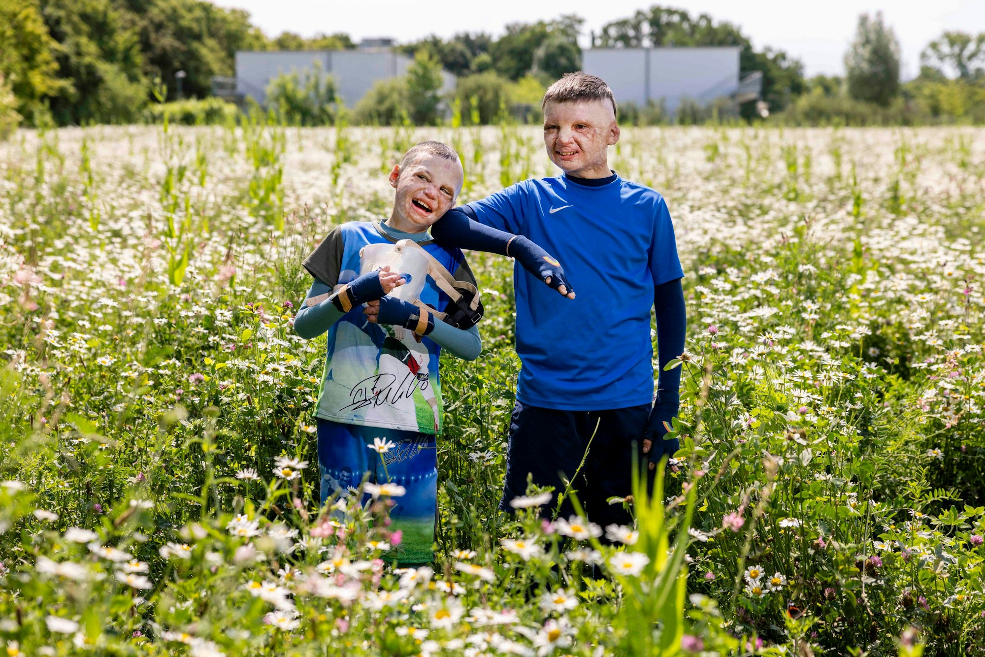 Zwei von Verletzungen gezeichnete Jungs stehen lachend in einem Feld voller Blumen.