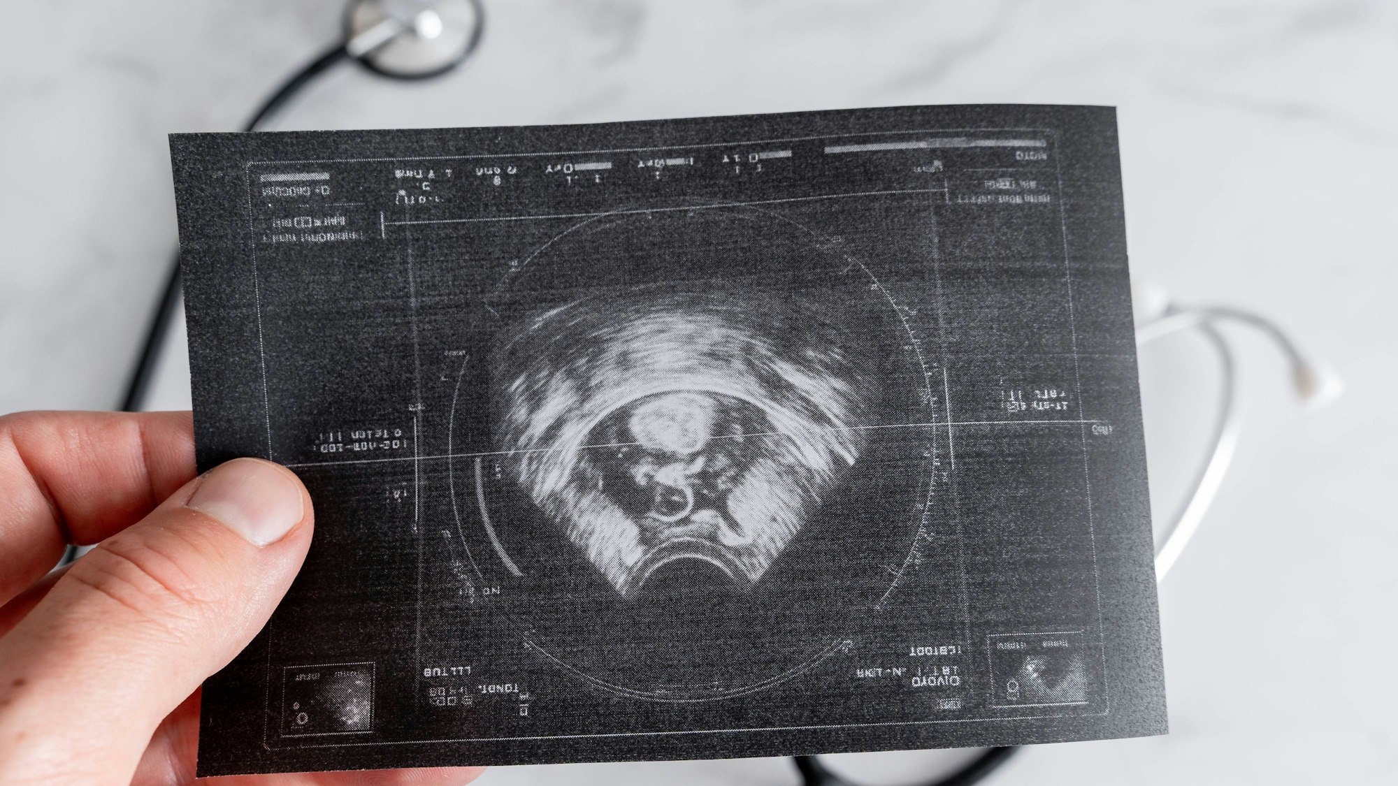 Ultraschallbild von Hand gehalten, Stethoskop im Hintergrund
