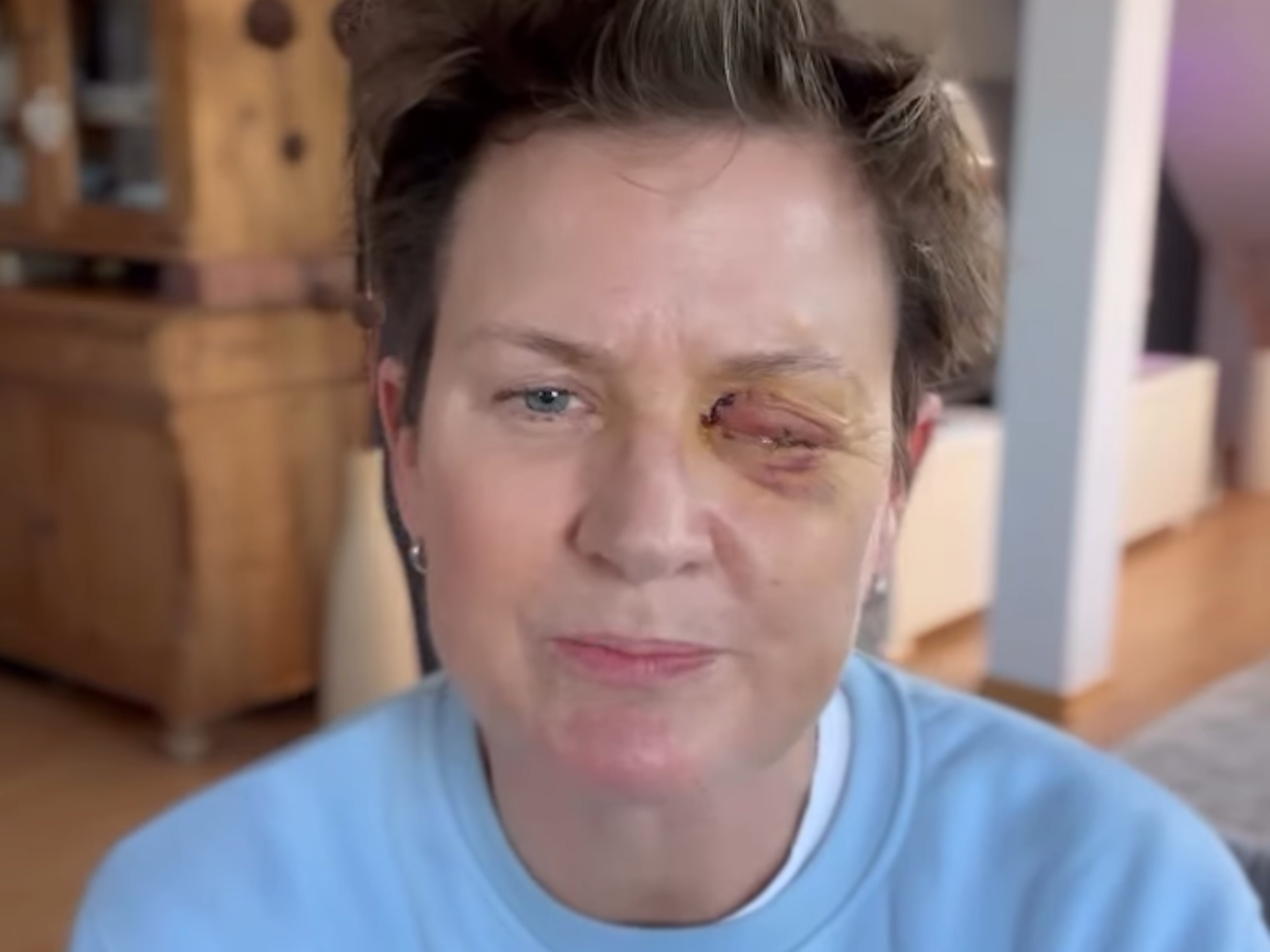 Astro-TV-Moderatorin Andrea Plewig verliert wegen Böller ein Auge