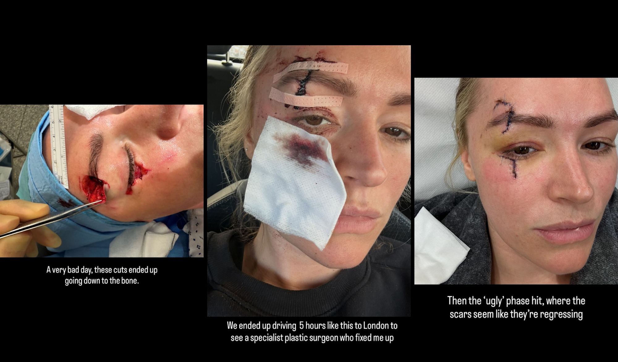 Laura Woods mit Wunden und Narben im Gesicht.